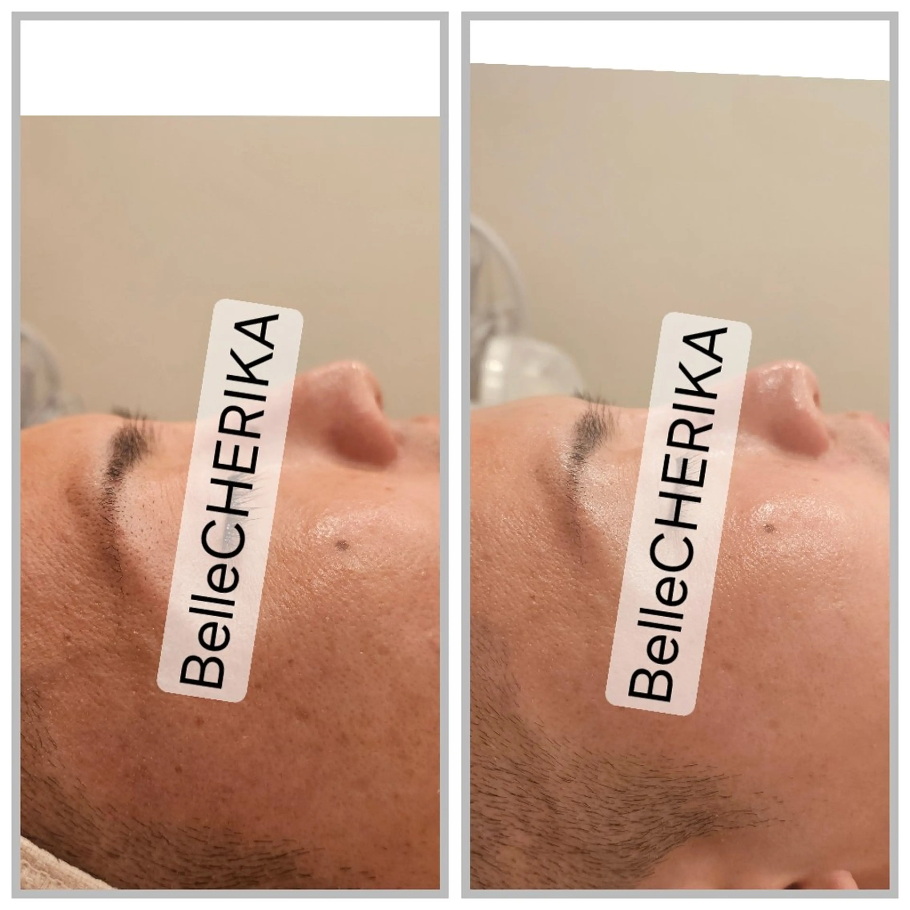 エステ ベル チェリカ 三城のエステ・リラクイメージ