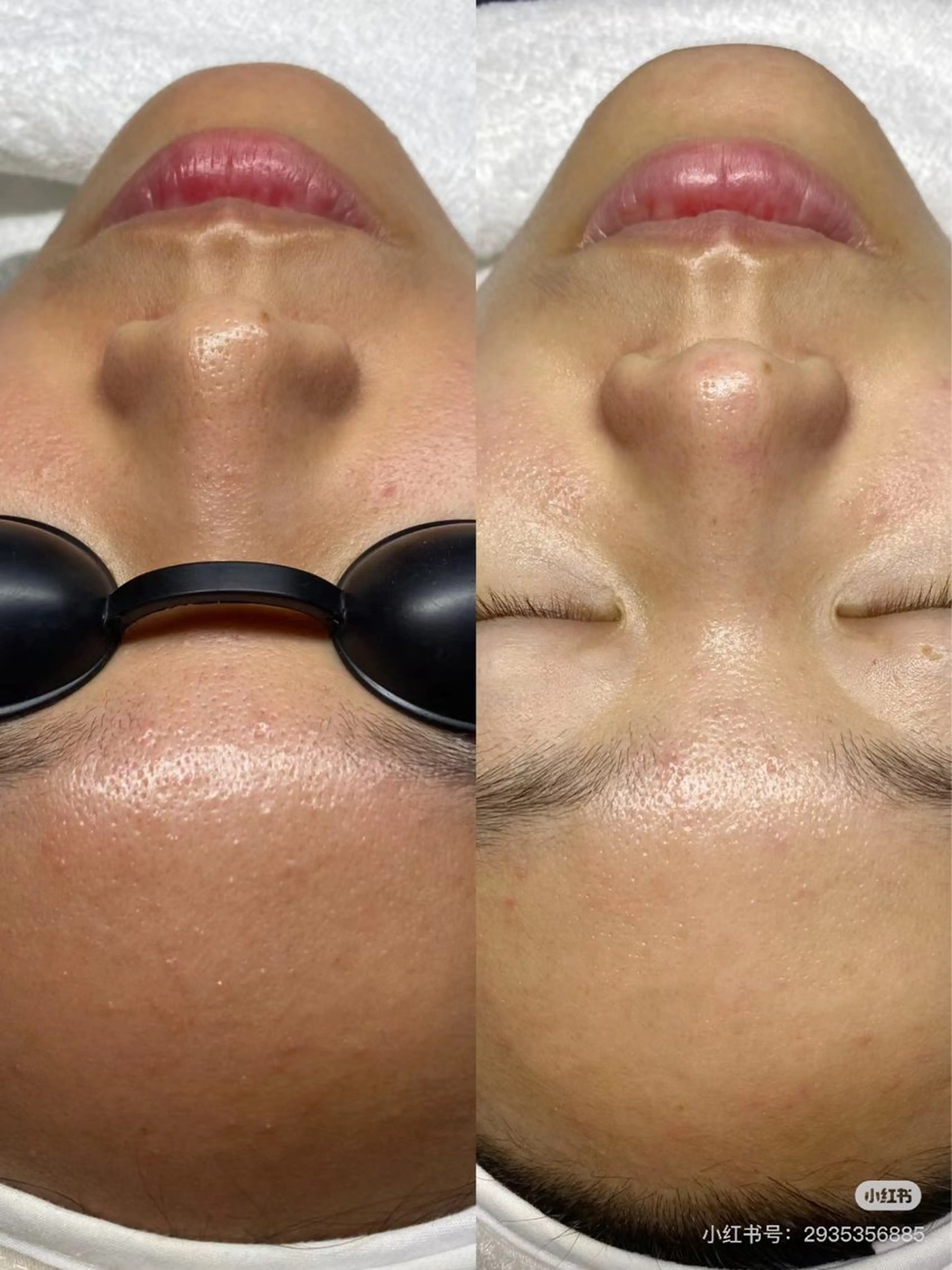 マツエク・マツパ 脱毛 aliaハイフ&水光ジェットサロン所属・aliaハーブ水光店 エステティシャン募集のエステ・リラクイメージ