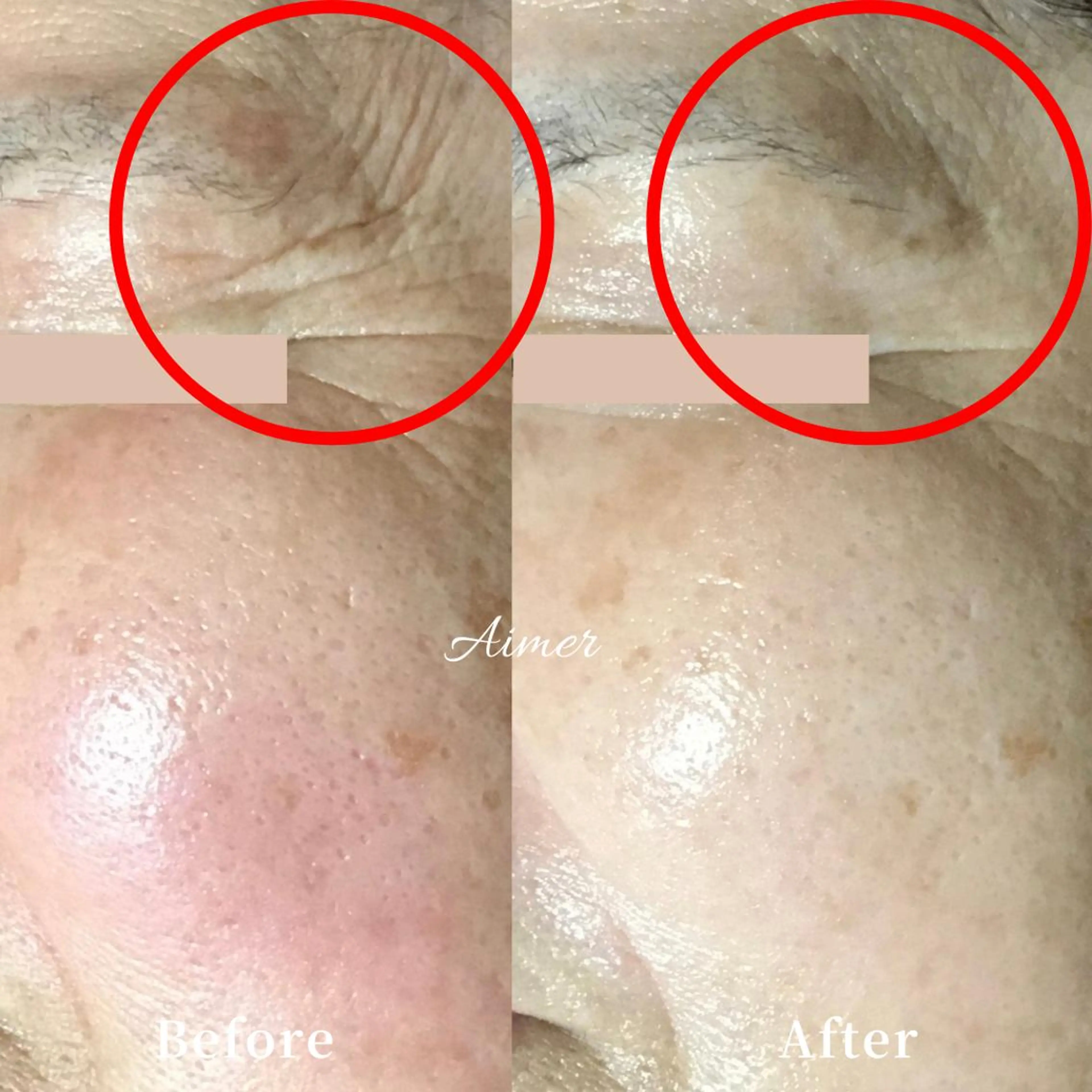 エステサロン Aimer（エメ）所属・エステサロン Aimer（エメ）のエステ・リラクイメージ