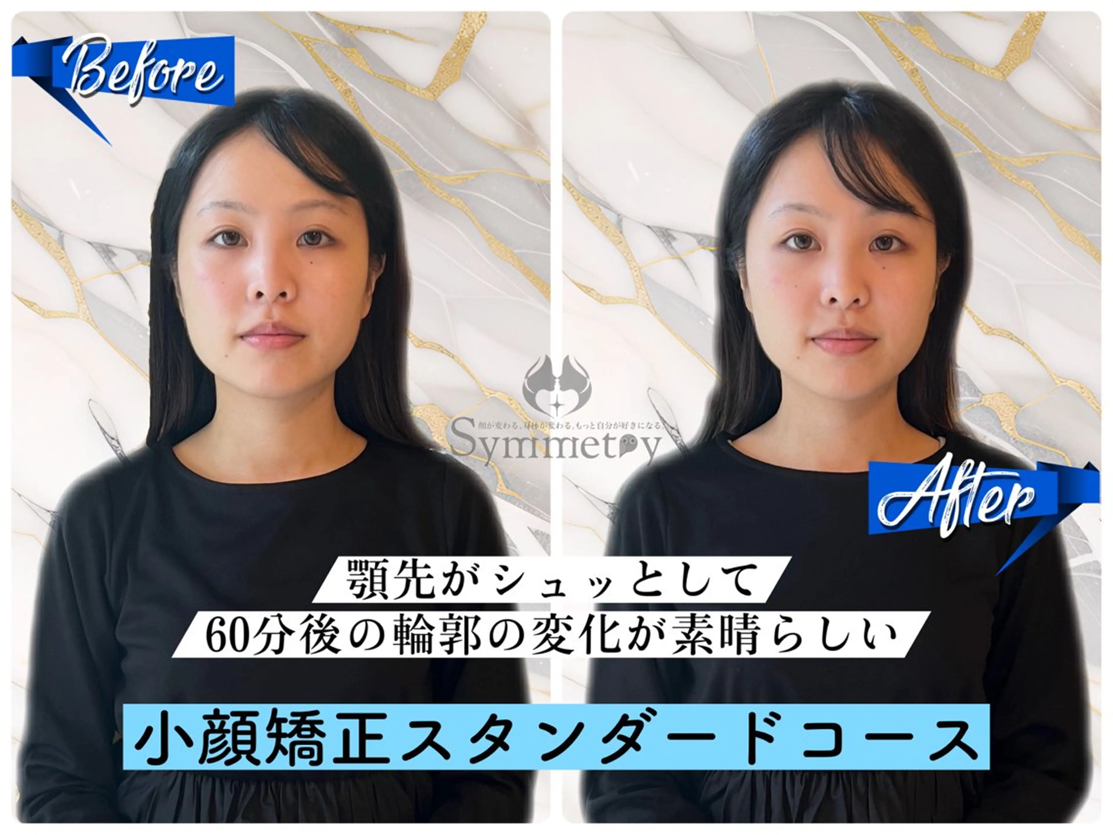 《小顔矯正スタンダードコース💆♀️》小顔矯正 60分 ¥12,100→初回¥4,980の写真