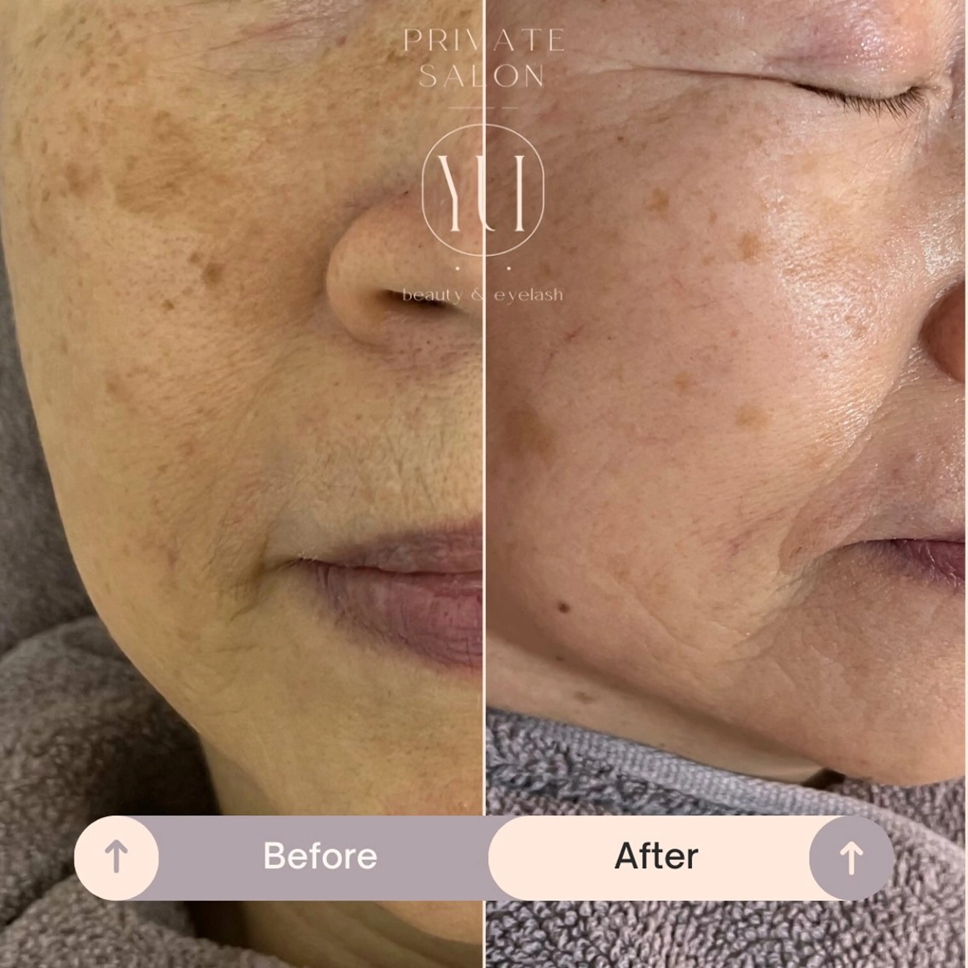 1ヶ月後も半分残る 高持続LEDエクステのマツエク・マツパデザイン