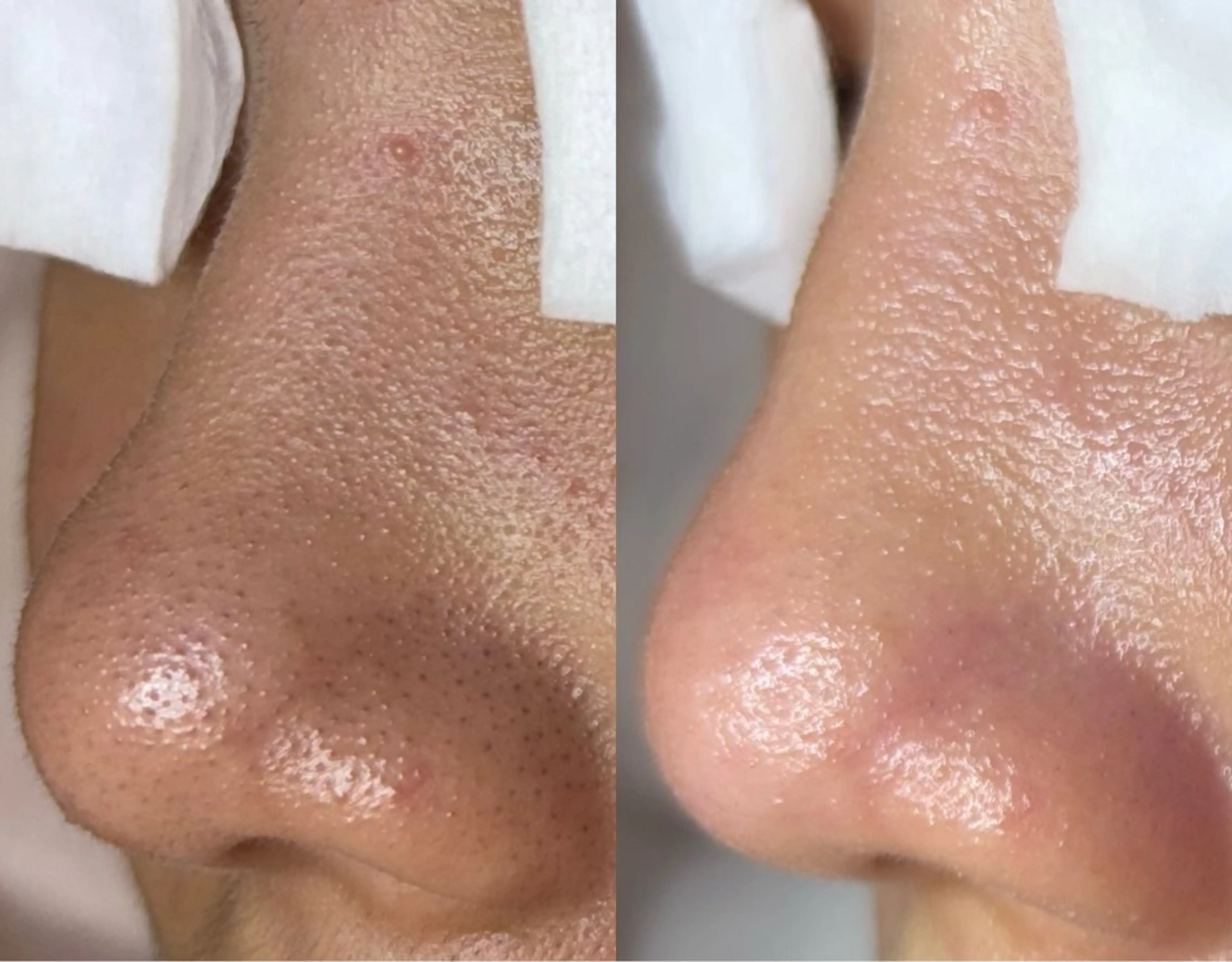 エステ リラク 肌改善・リンパサロン CoCoxiaのエステ・リラクイメージ