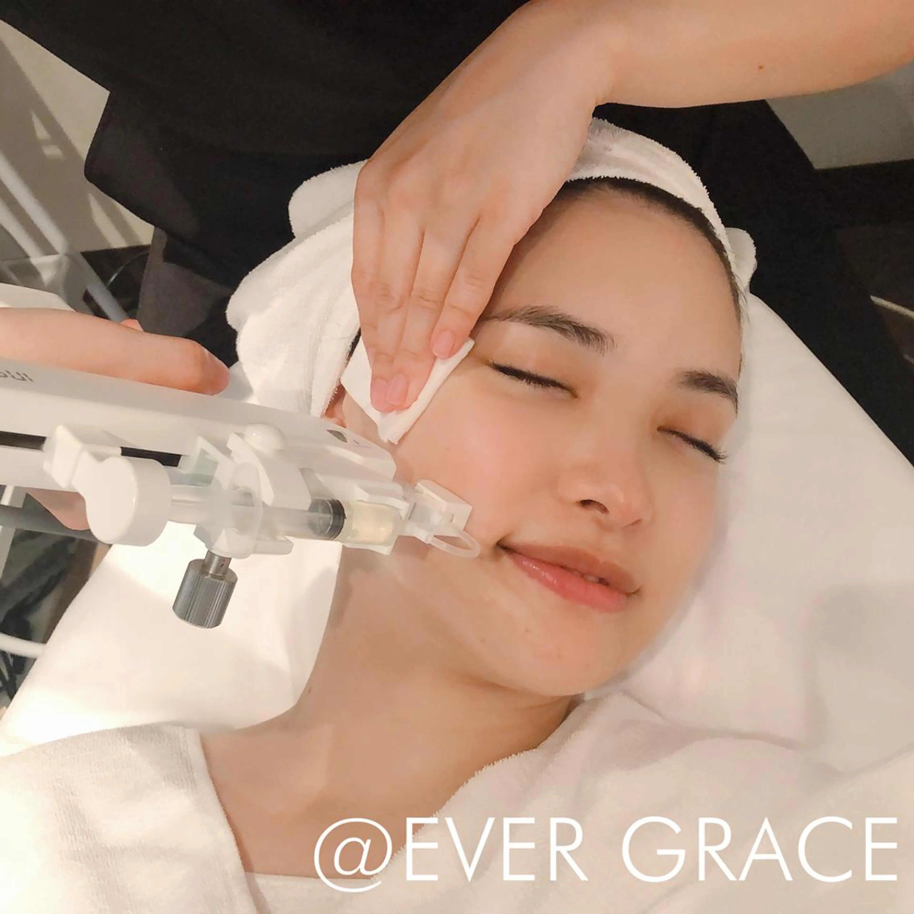 【ニキビ、シミシワ改善】国産高濃度ヒト幹細胞+毛穴汚れごっそりの写真