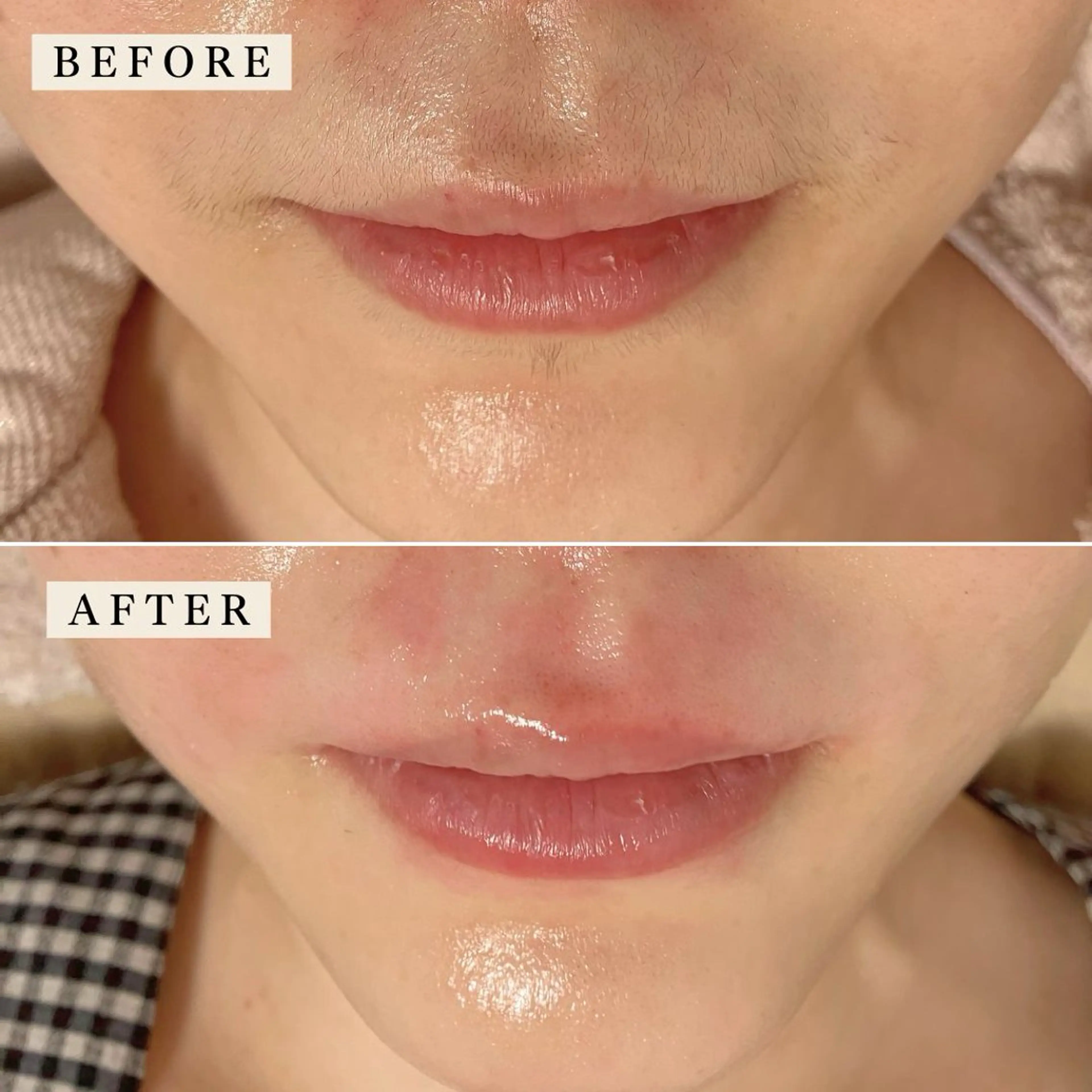 その他 【産毛・眉毛ケア＆肌質改善サロン】＊BiBi＊beautysalon所属・眉･産毛専門BiBi 糸脱毛スレッティングのエステ・リラクイメージ