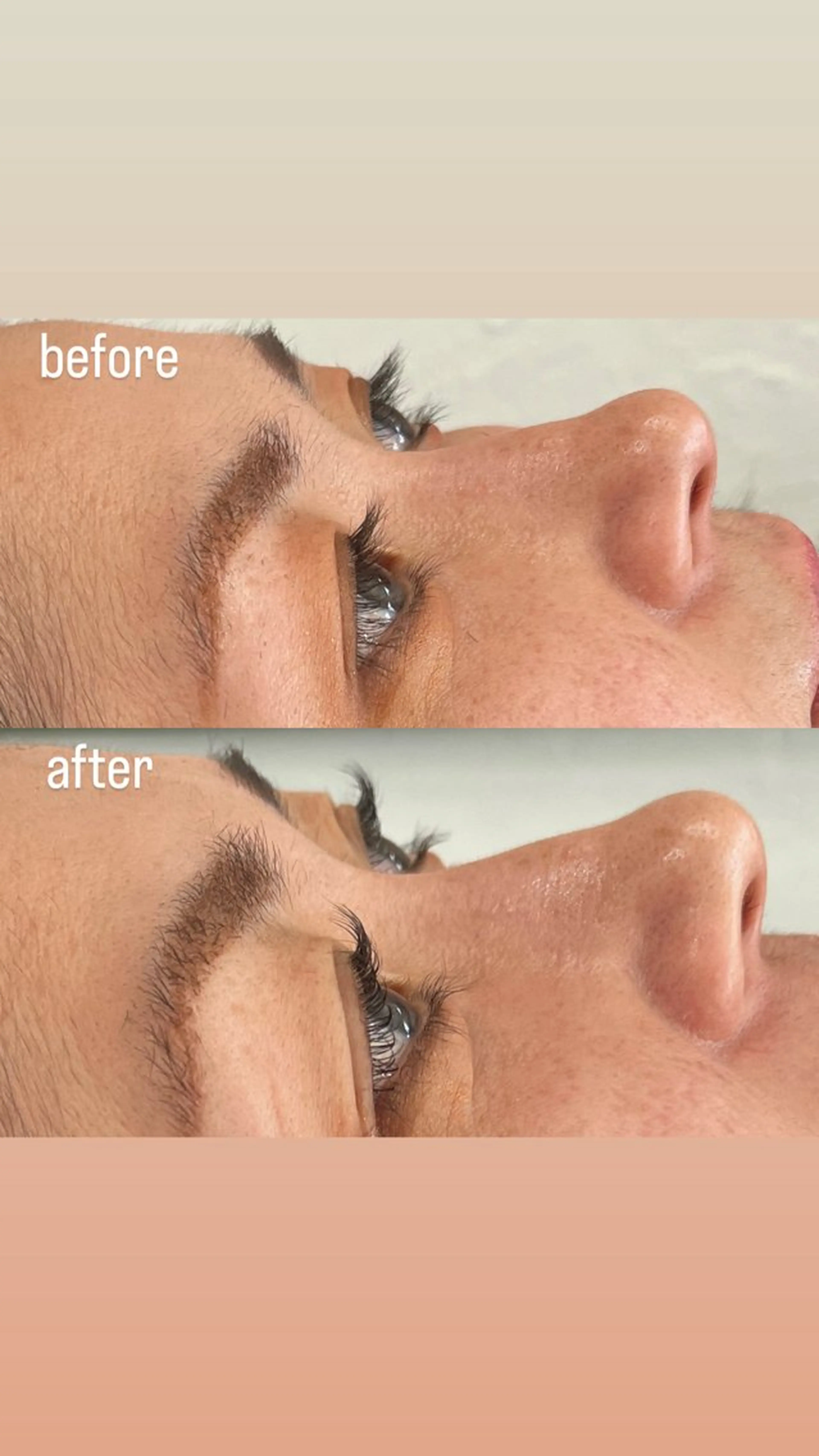 まつげパーマの写真