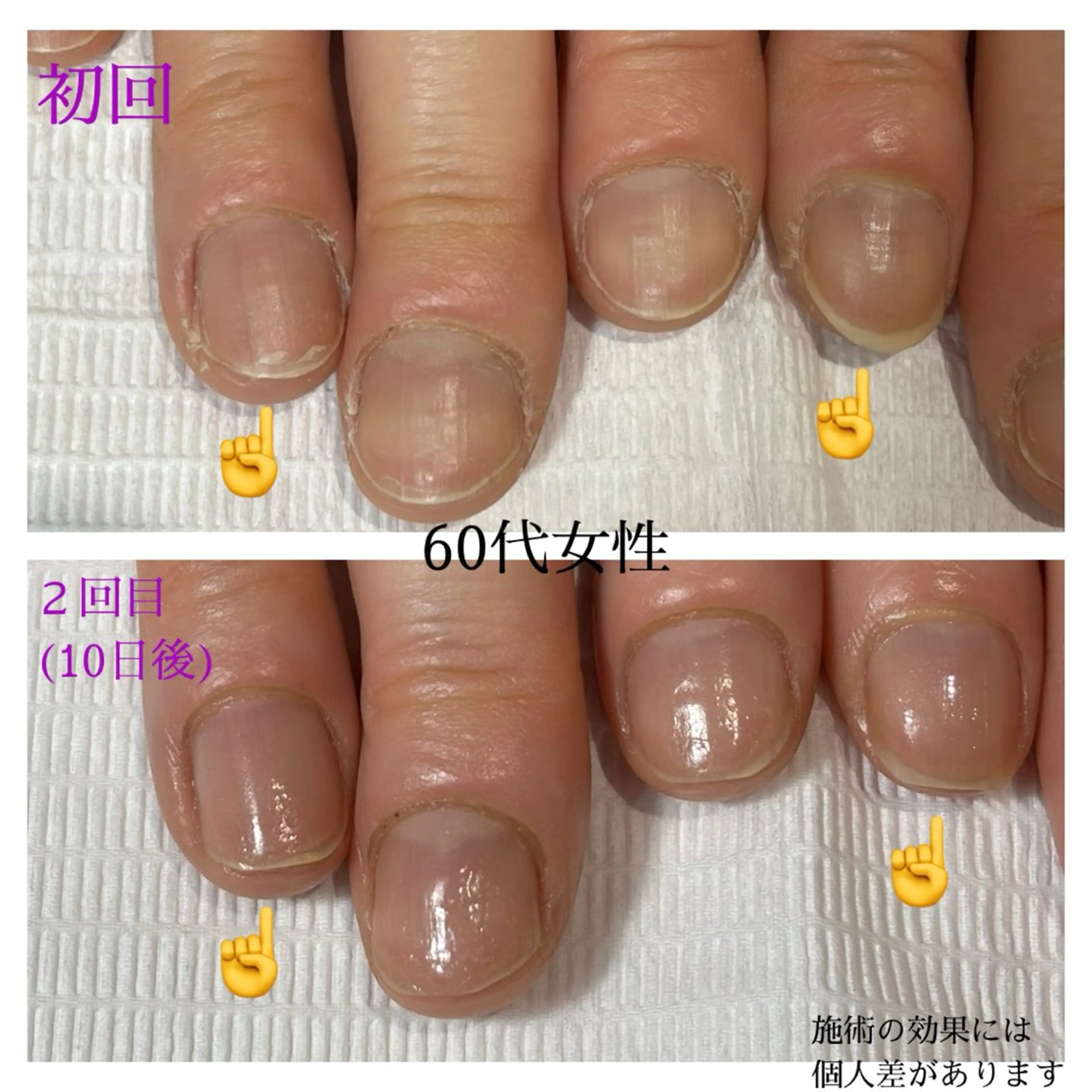 ネイル 自爪育成専門サロン エムロードゥ池下のネイルデザイン