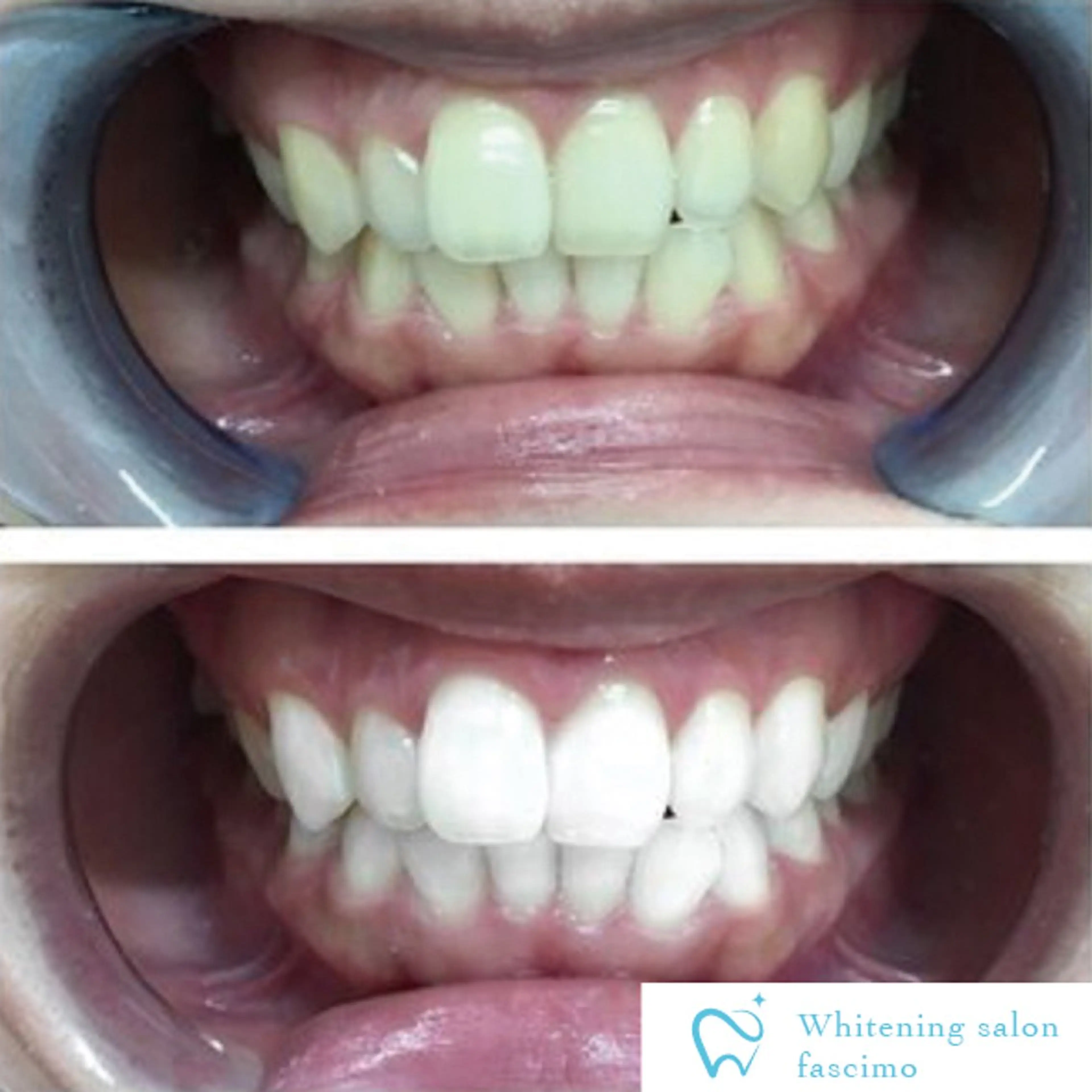 セルフホワイトニングサロンfascimo所属・ホワイトニングサロン fascimo新座店のその他イメージ
