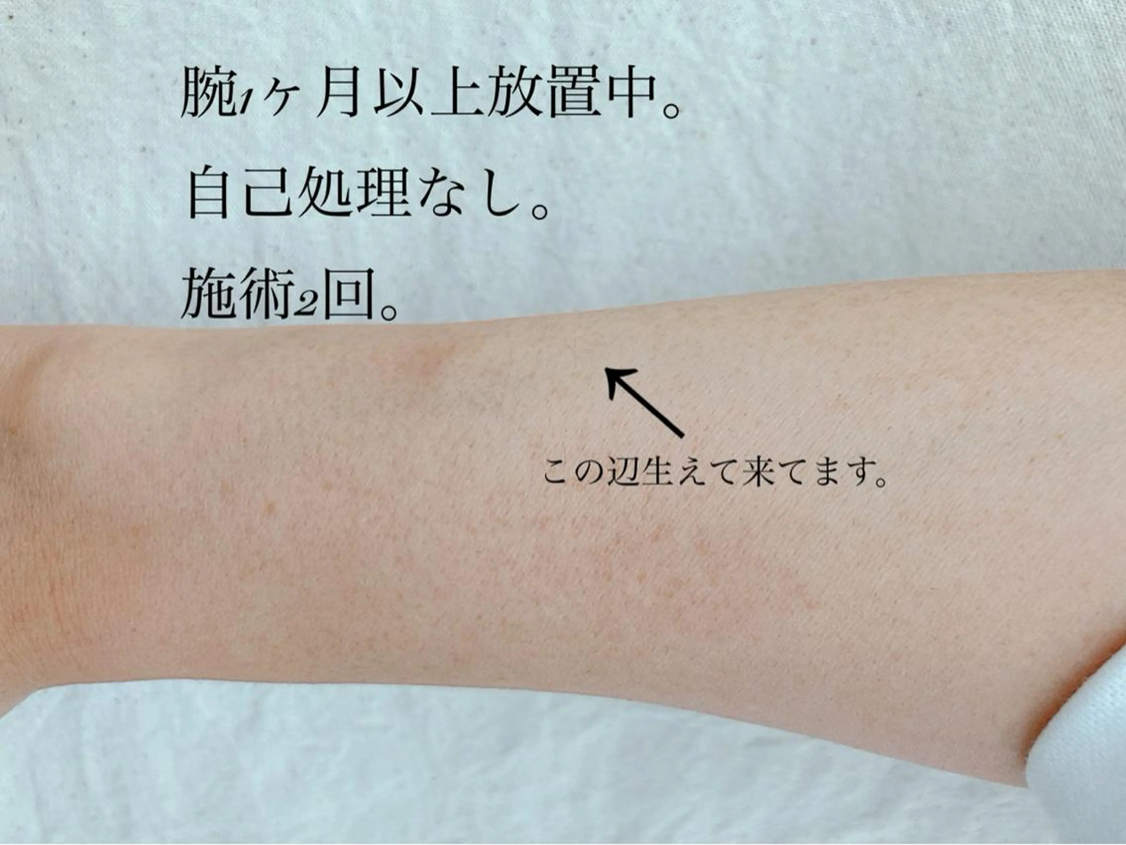 セルフ脱毛アトリエao.所属・セルフ脱毛 atelier aoのエステ・リラクイメージ