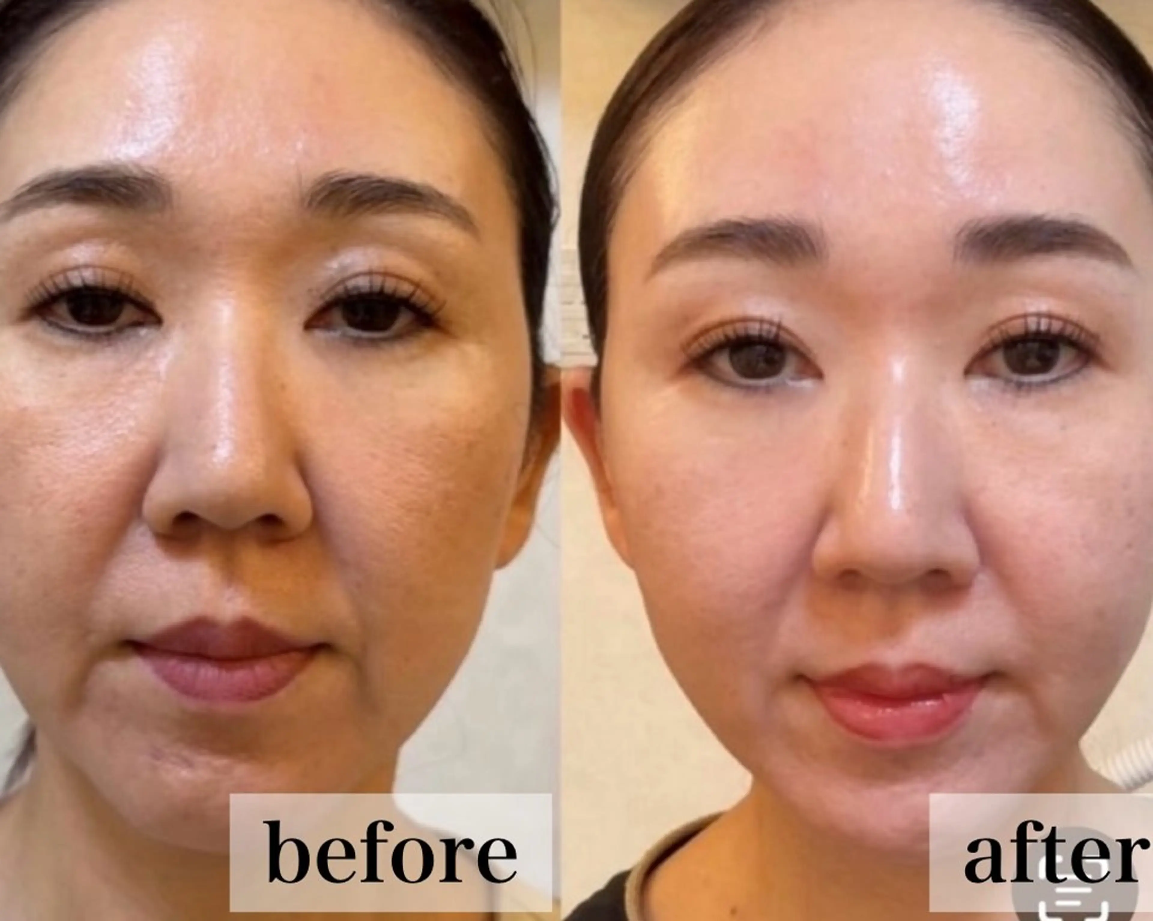 エステ リラク 【vidyto】ヴィディトゥ所属・肌管理サロン vidyto　MOEのエステ・リラクイメージ