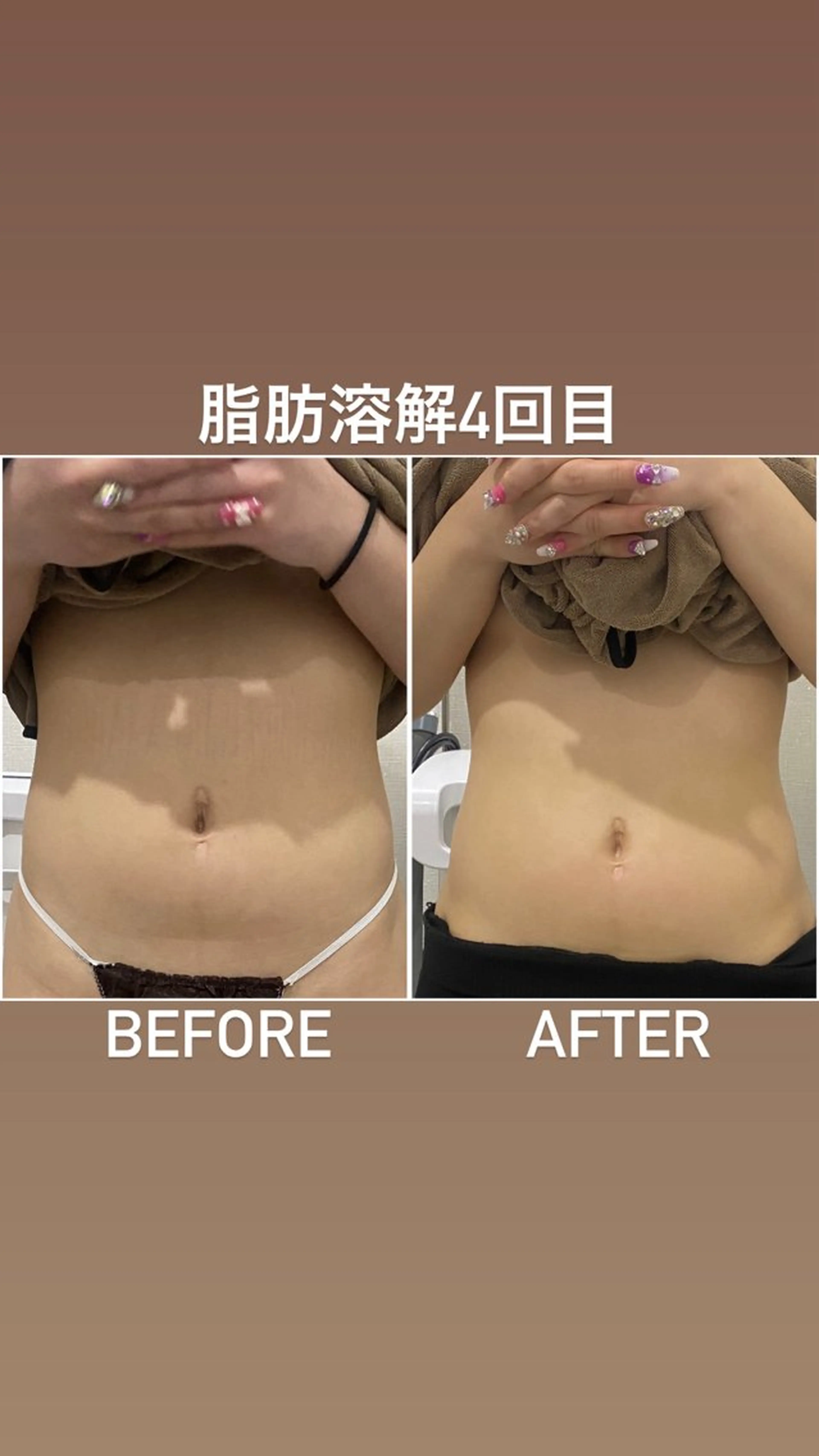 エステ 毛穴洗浄・痩身・脱毛 /アルカンジュのエステ・リラクイメージ