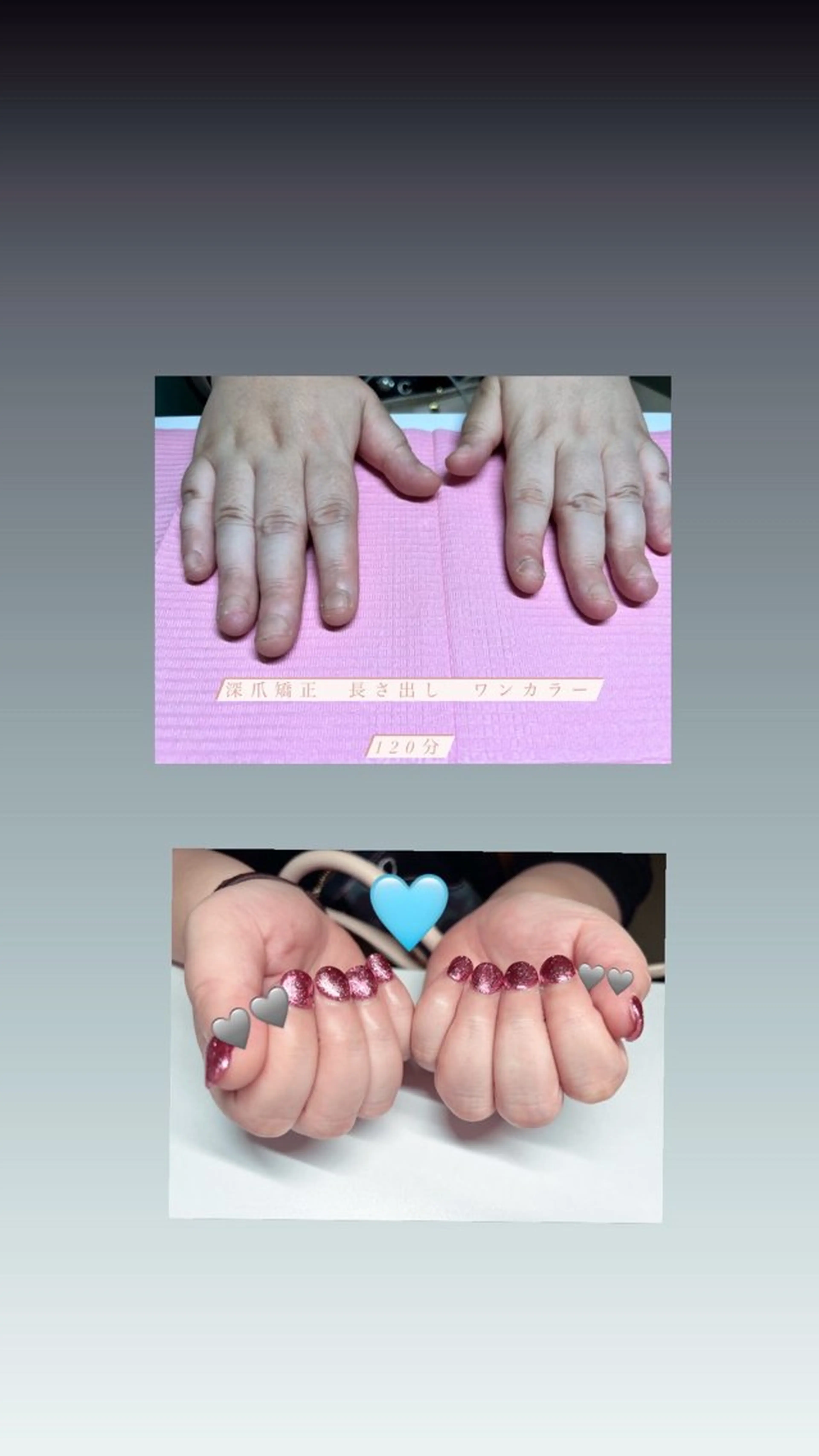 メンズ ネイル 爪ケア/深爪 自爪育成 🐰えむのネイルデザイン