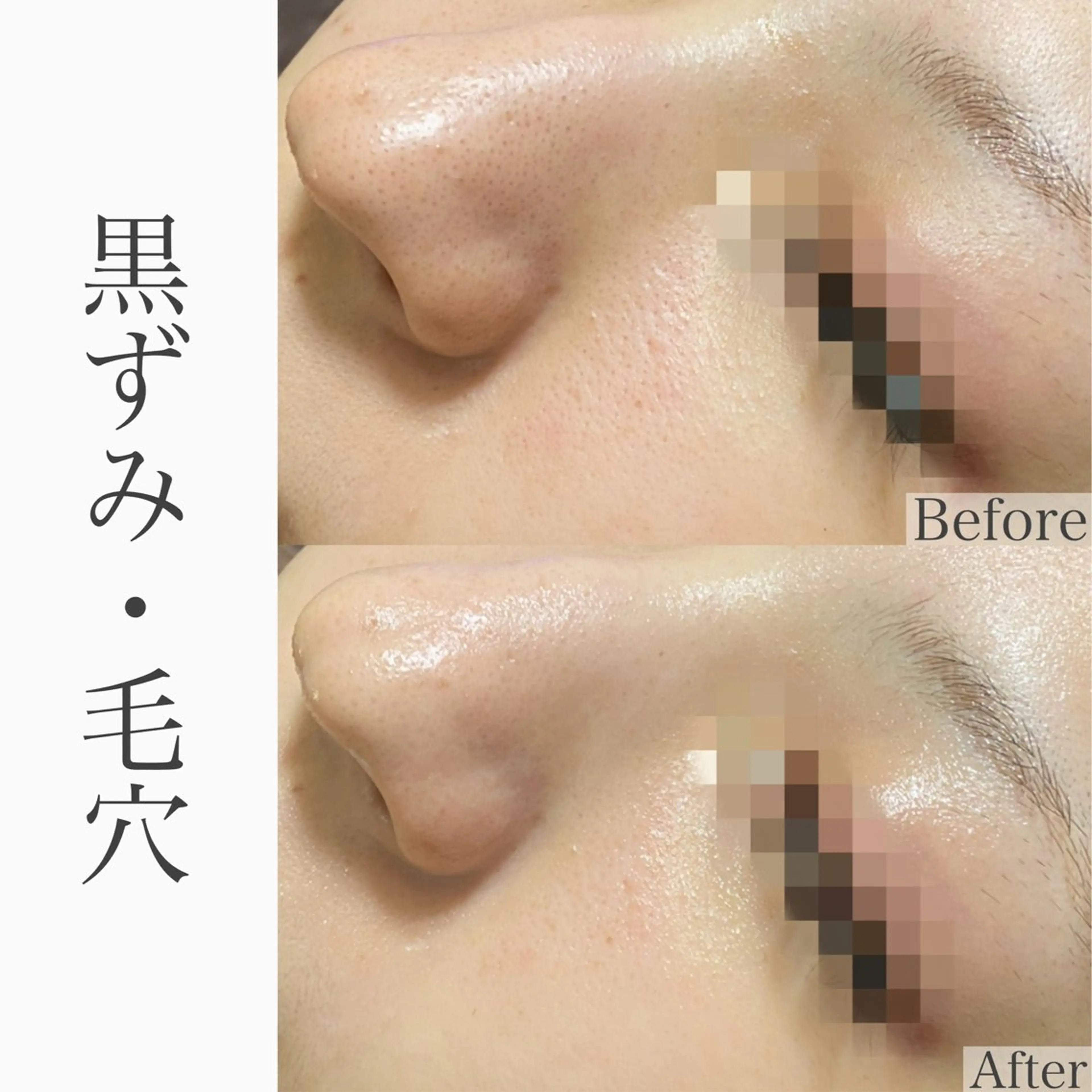 ハーブピーリング専門 BIOEL横浜のエステ・リラクイメージ