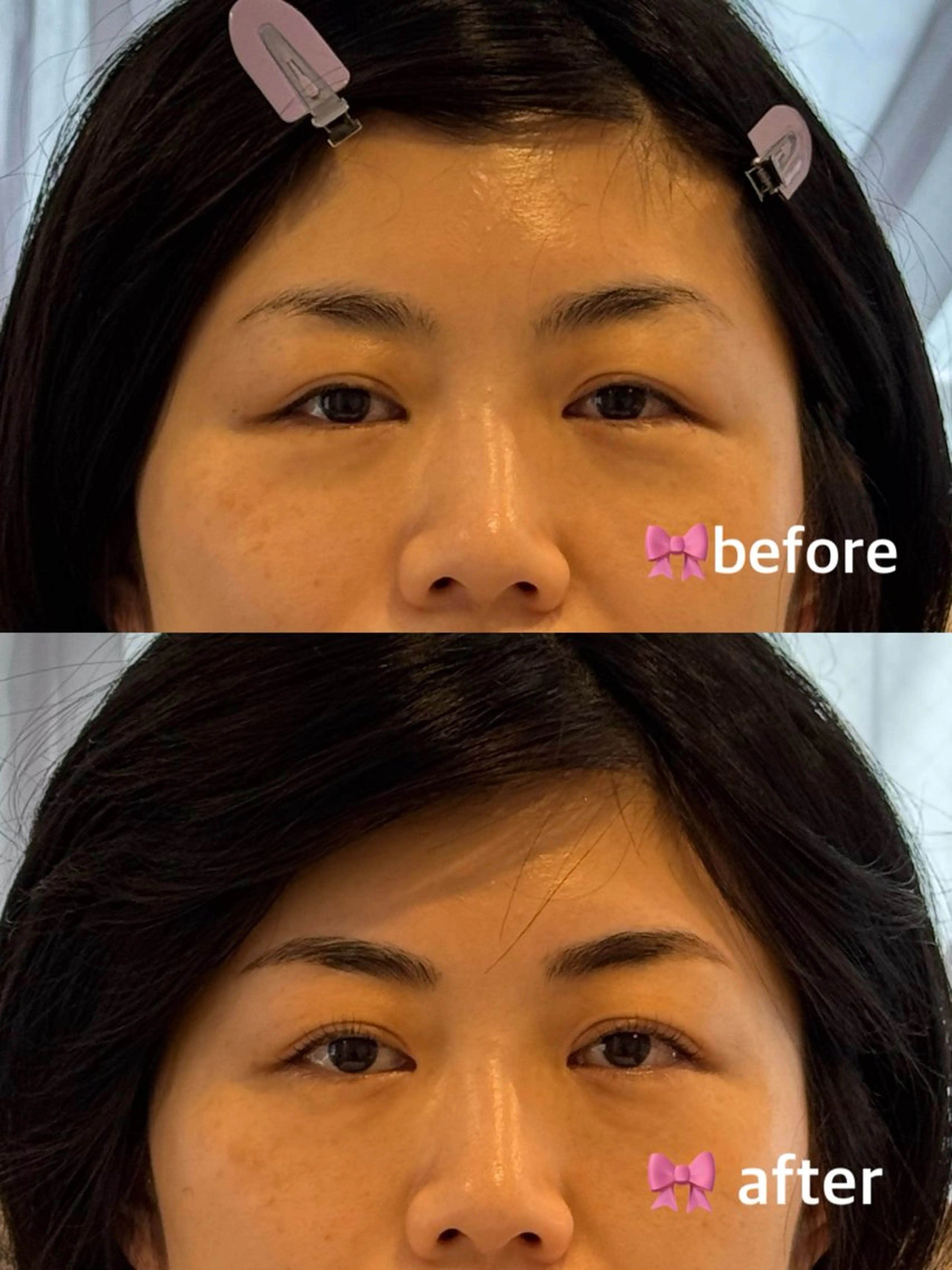 アイブロウ マツパ Lim五反田所属・TSUNA 🌙 Lim 五反田のマツエク・マツパデザイン