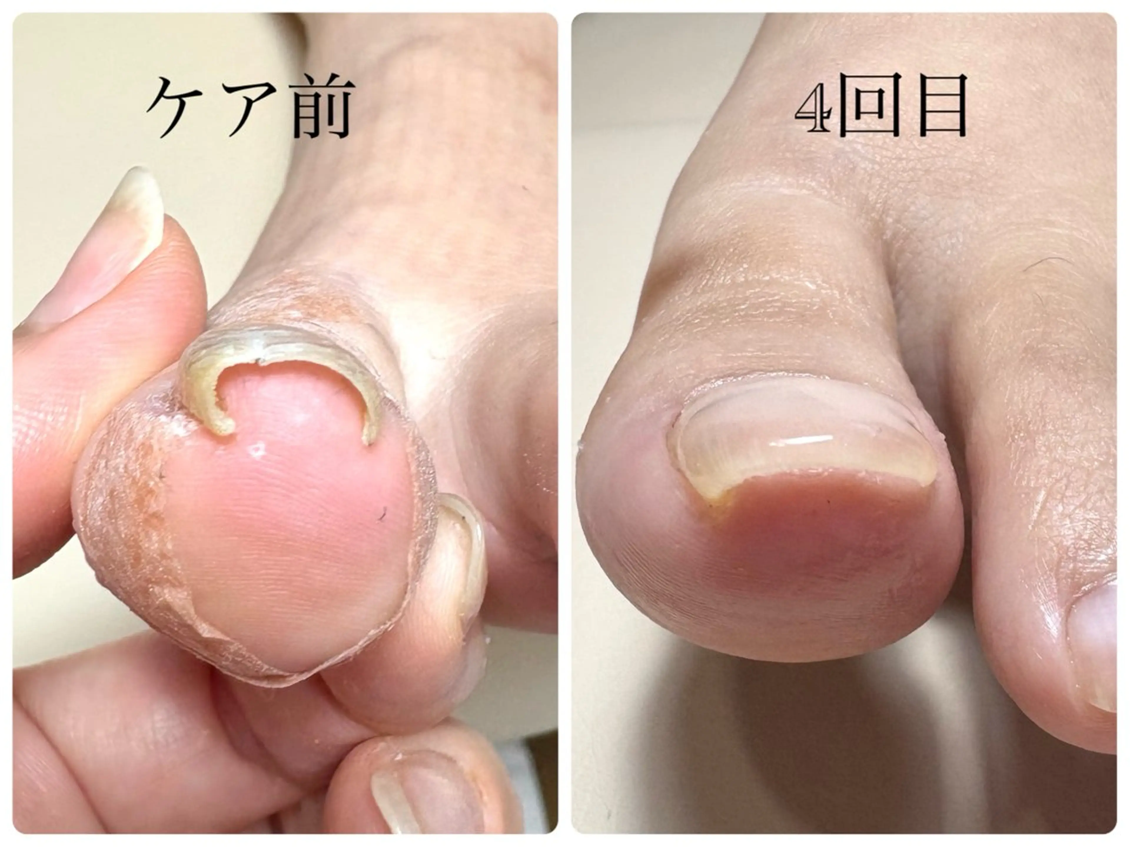 荒井 恵のネイルデザイン