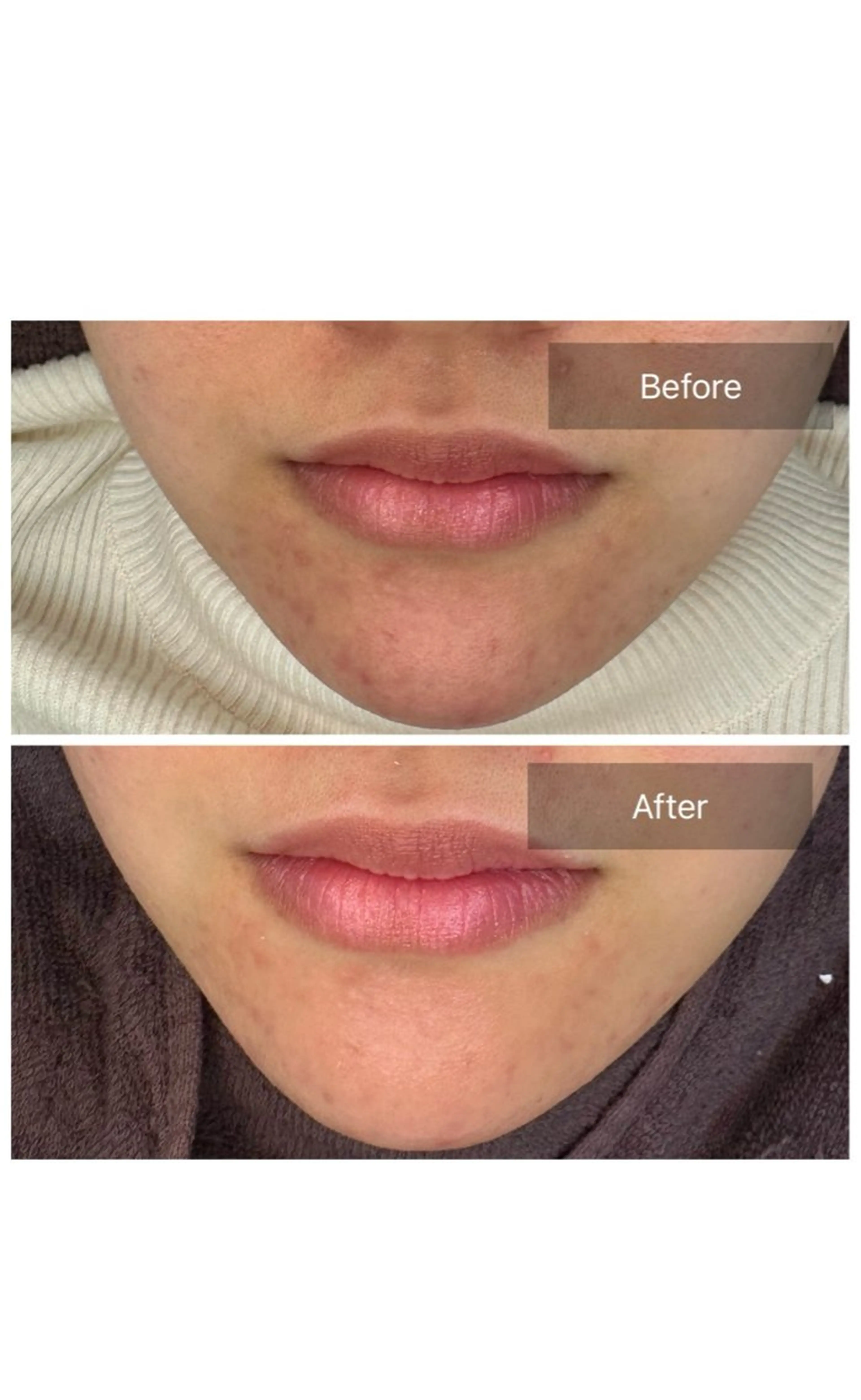 脱毛 トータルしみケア専門 NICA(ニカ)のエステ・リラクイメージ