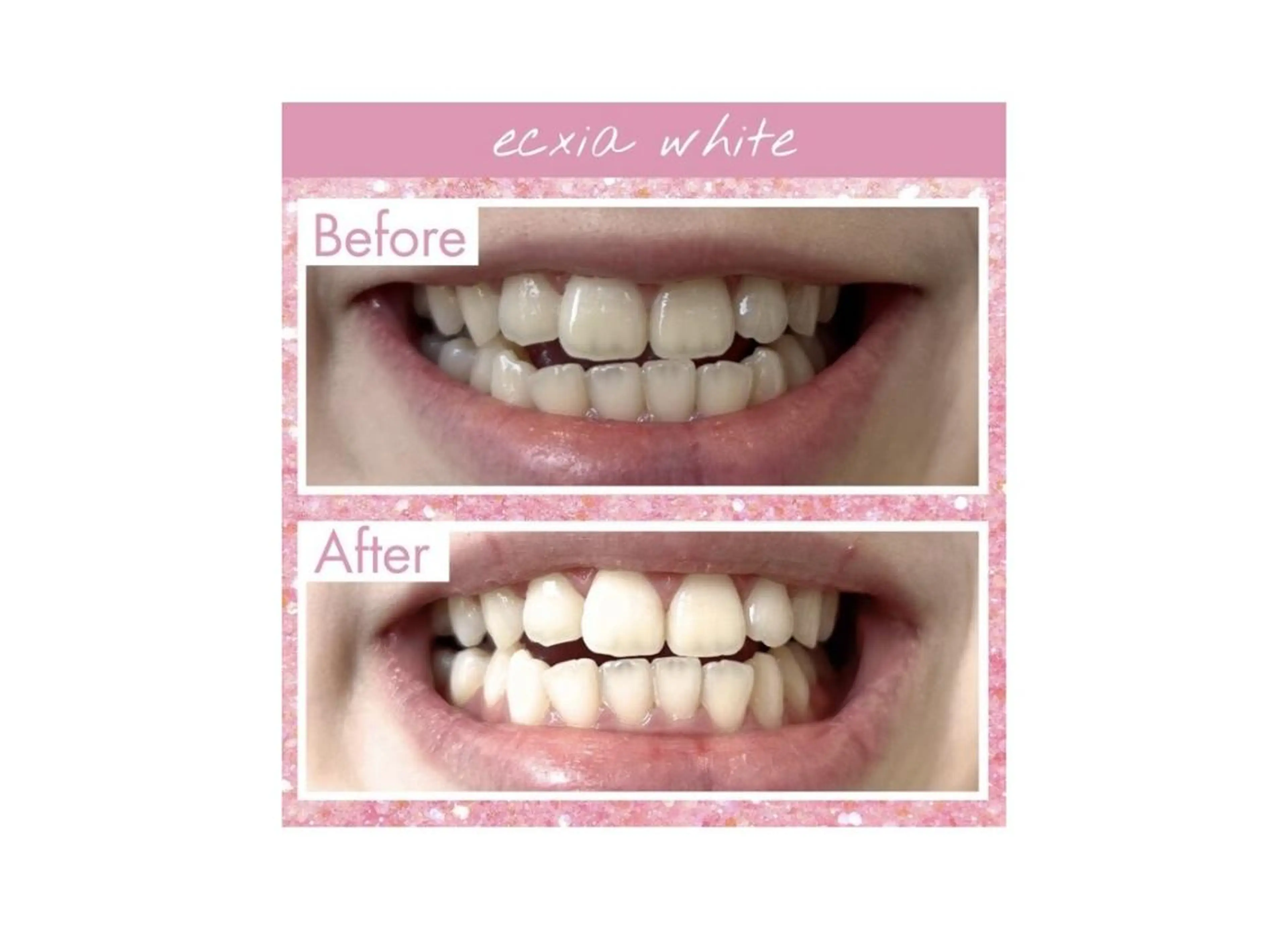 その他 セルフホワイトニング エクシア大阪梅田店のその他イメージ