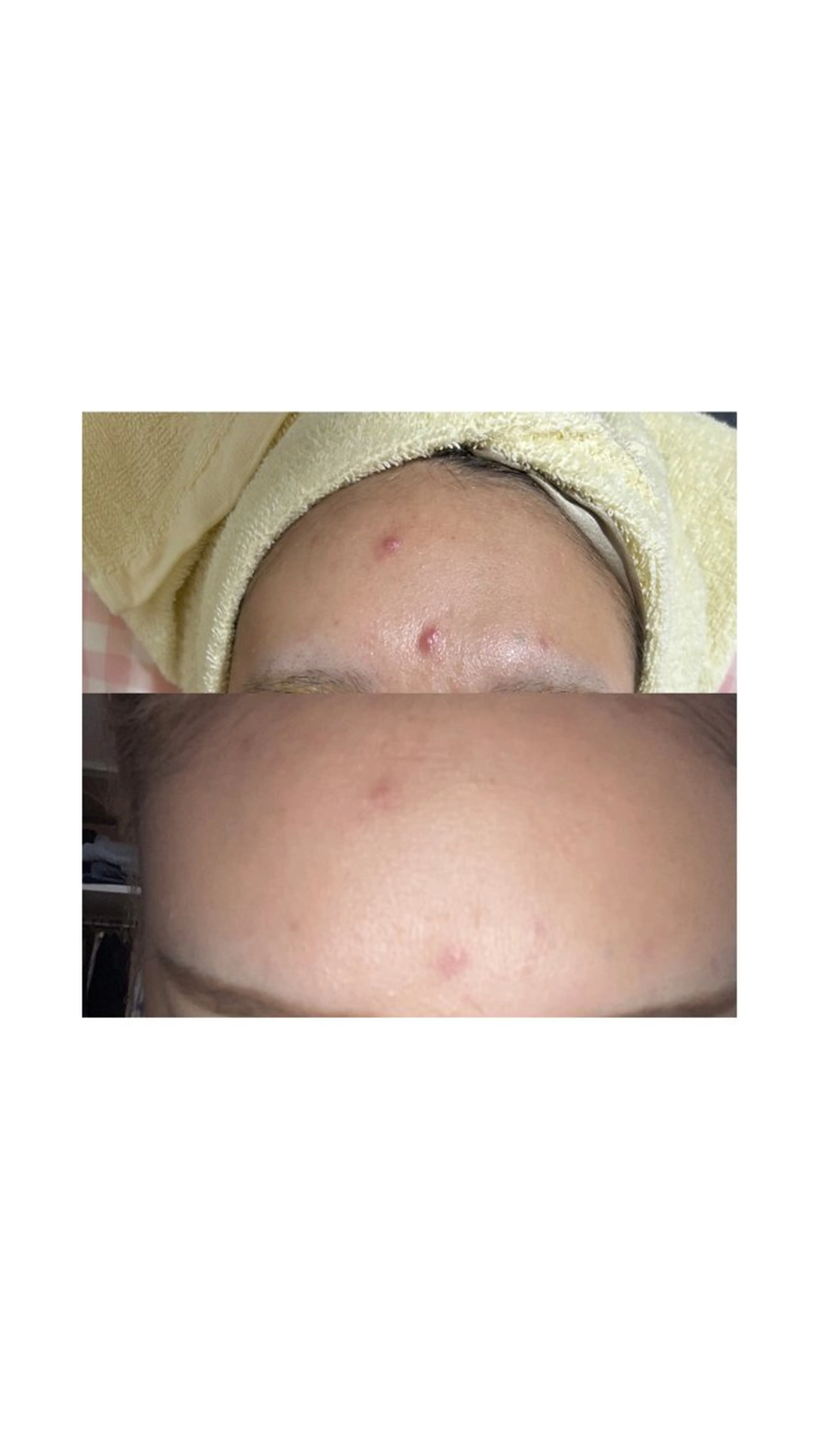 eto.所属・肌質改善サロンeto ニキビ・ニキビ跡のエステ・リラクイメージ