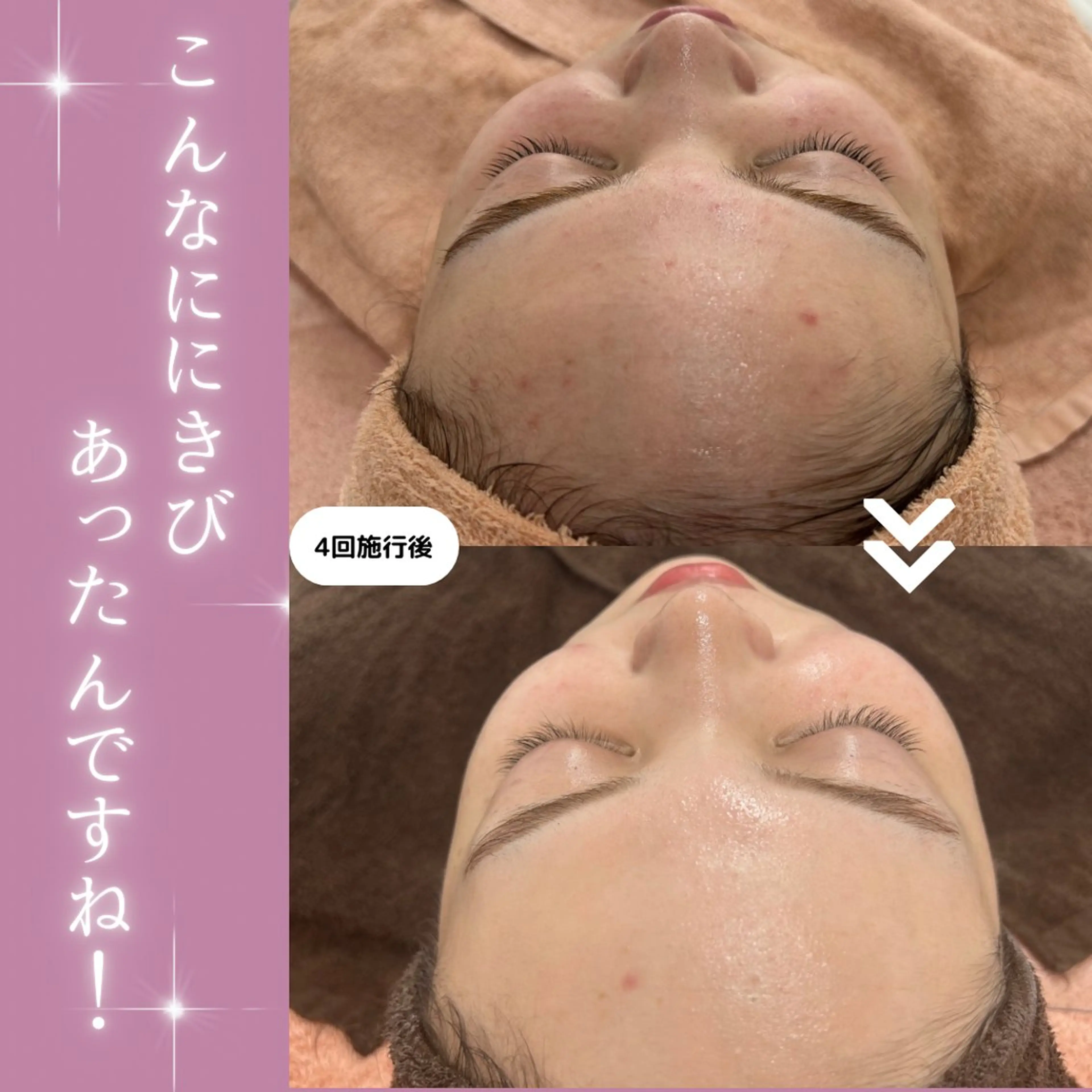 【現役看護師】高来 笑子のエステ・リラクイメージ