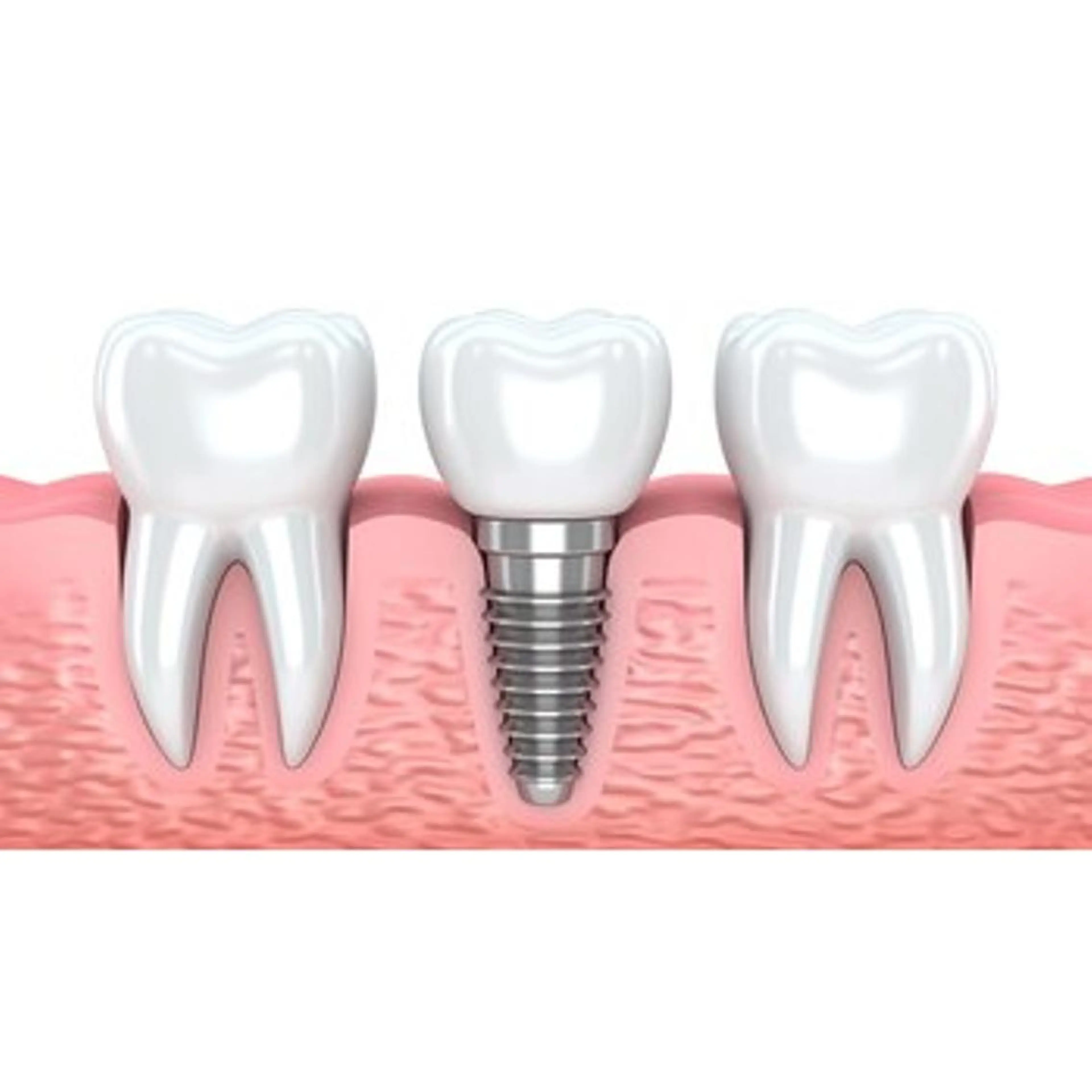 ロング パーマ その他 ホワイトニングサロン nico西葛西店のその他イメージ
