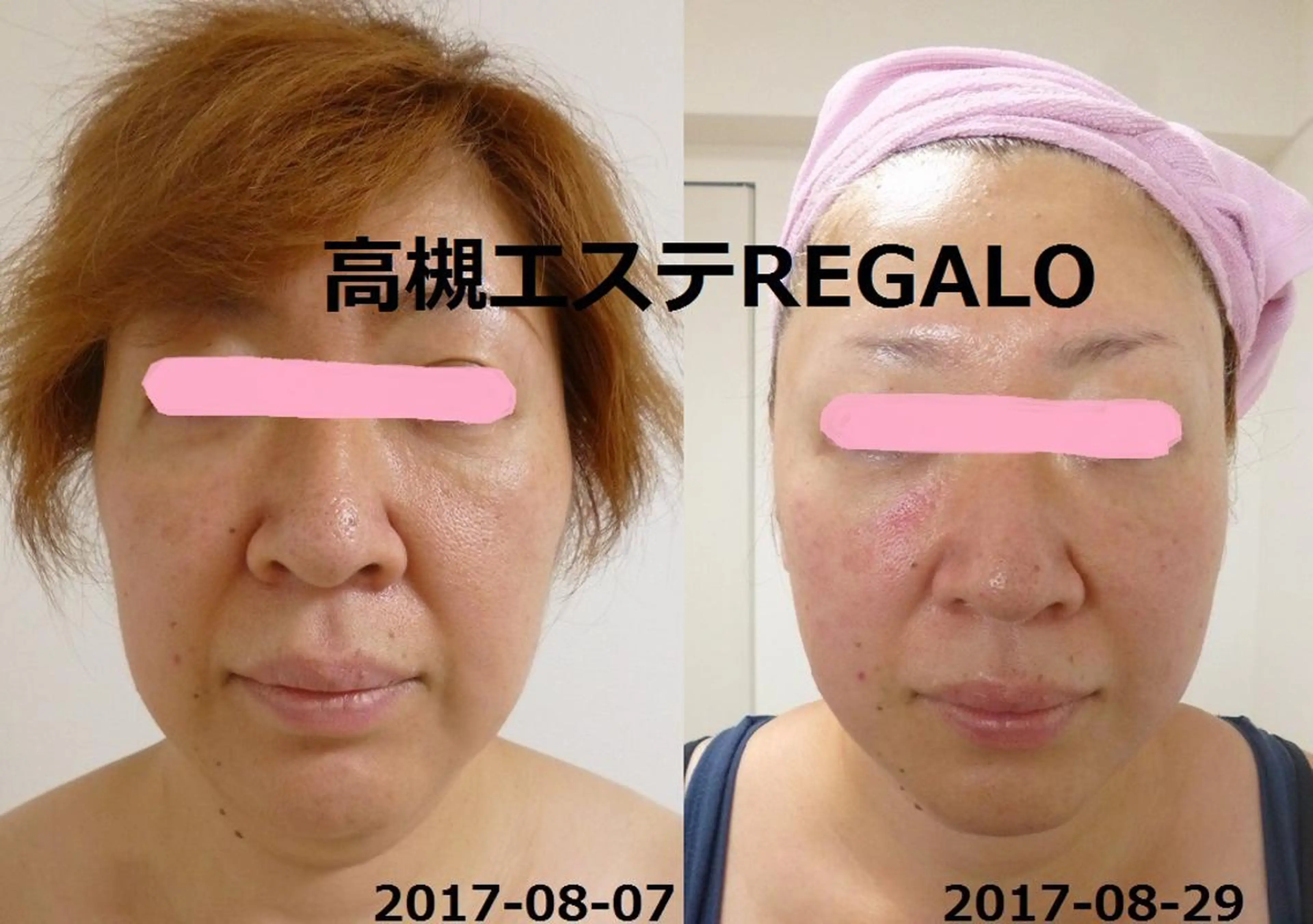 REGALO所属・矢野 さやかのエステ・リラクイメージ