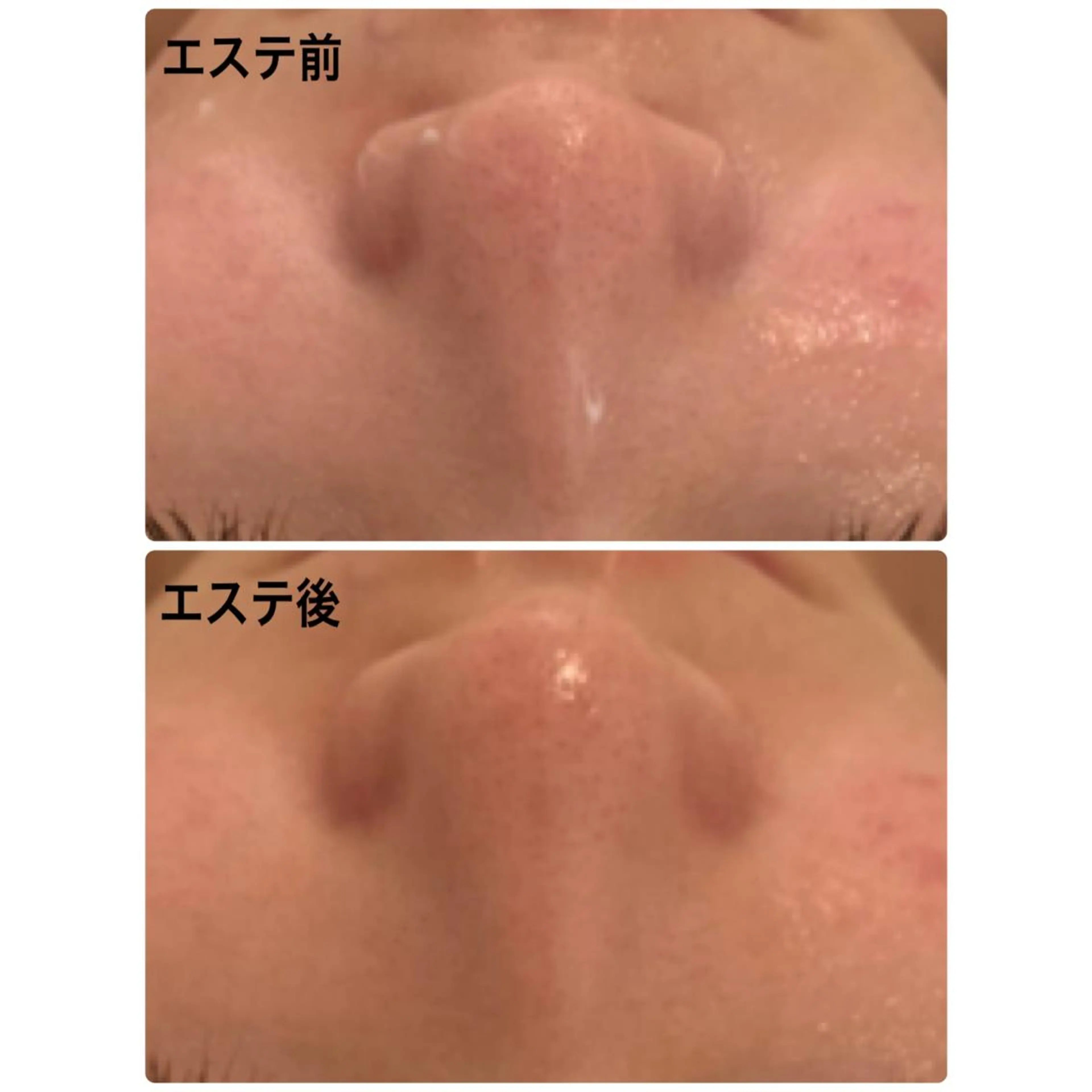 +M所属・竹ノ内 理恵のエステ・リラクイメージ