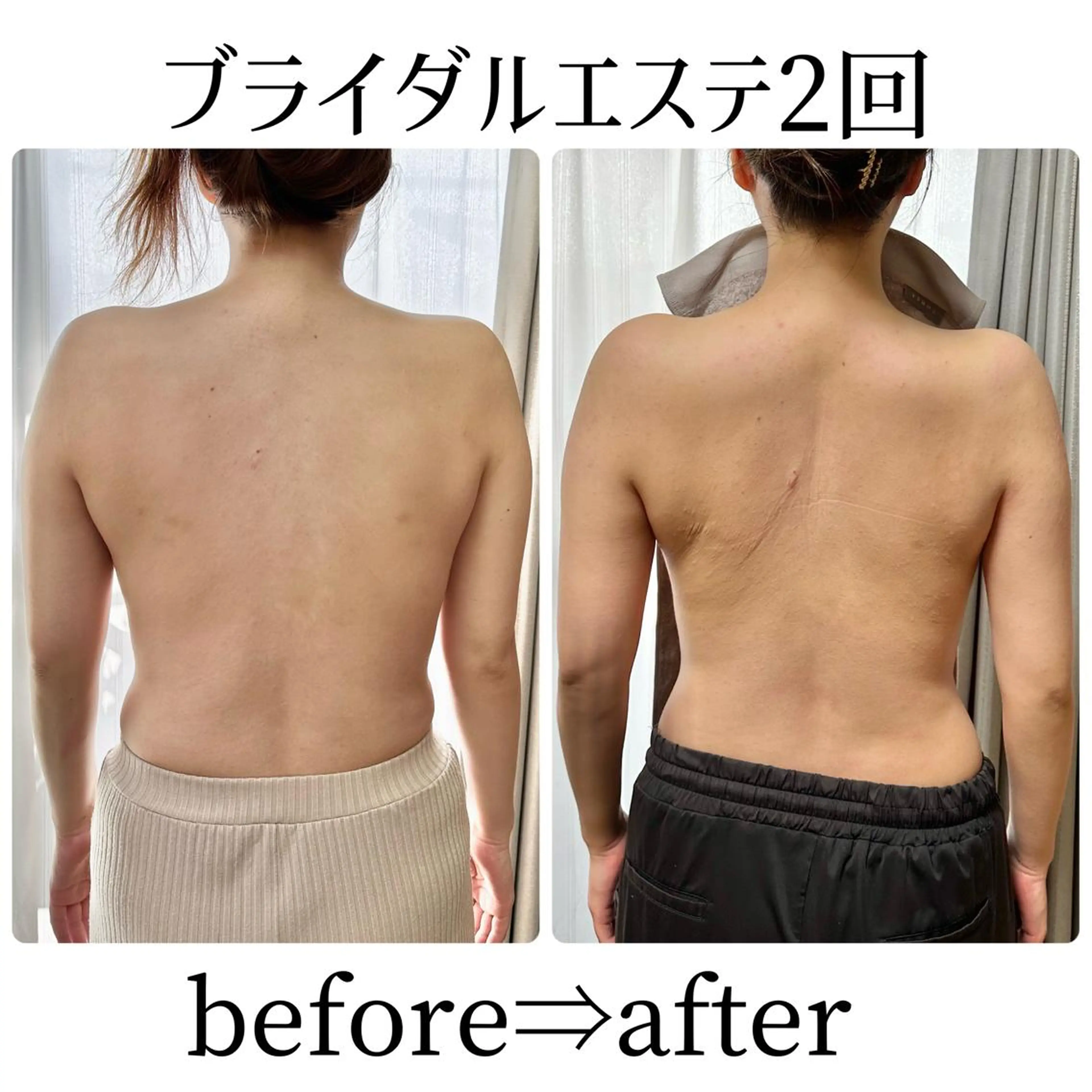 エステ リラク Nestime所属・Nestime 豊川エステのエステ・リラクイメージ