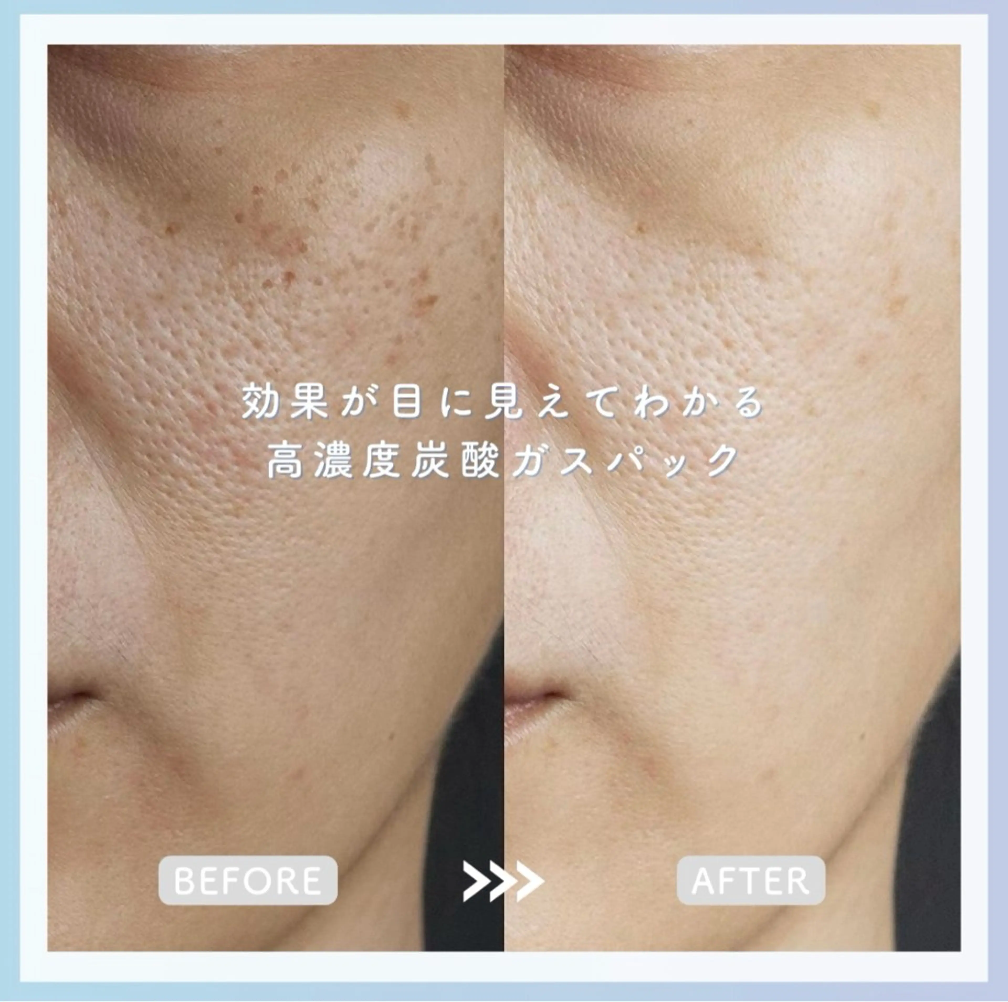 エステ Rifuro毛穴ケア &よもぎ蒸しサロンの眉毛・アイブロウイメージ