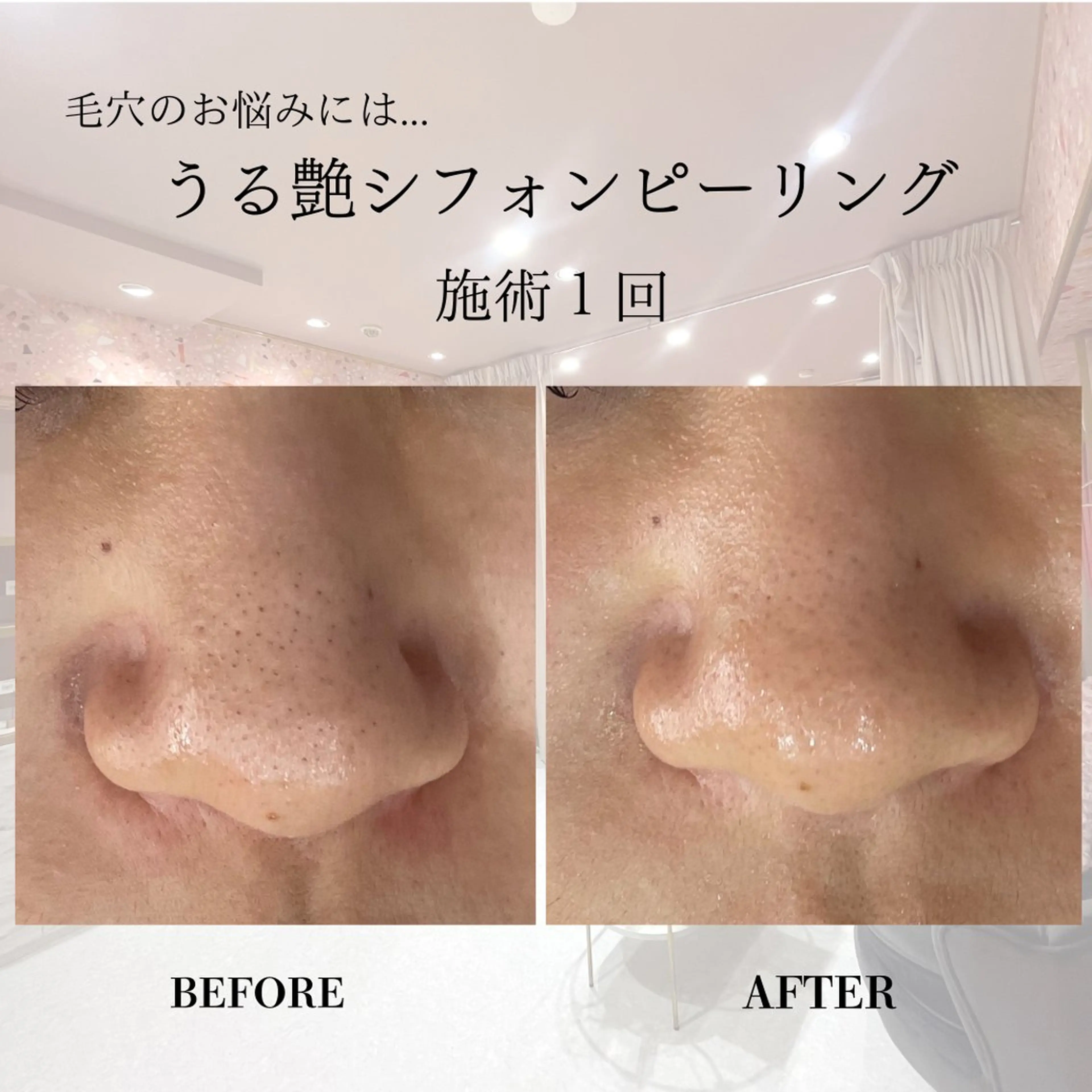 エステ 肌質改善専門サロン Bellmi/心斎橋のエステ・リラクイメージ