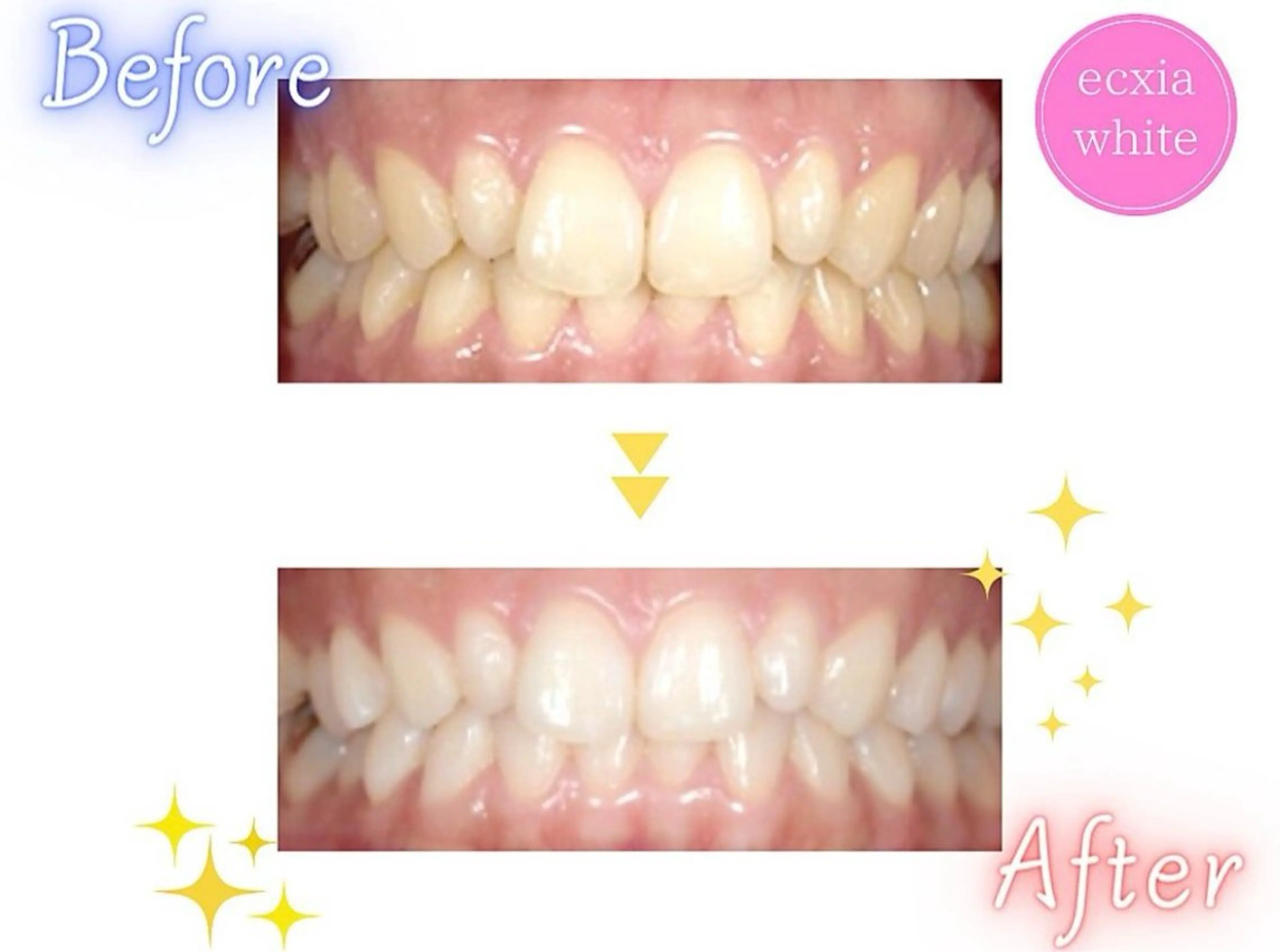 セルフホワイトニング エクシア武蔵小杉店のその他イメージ