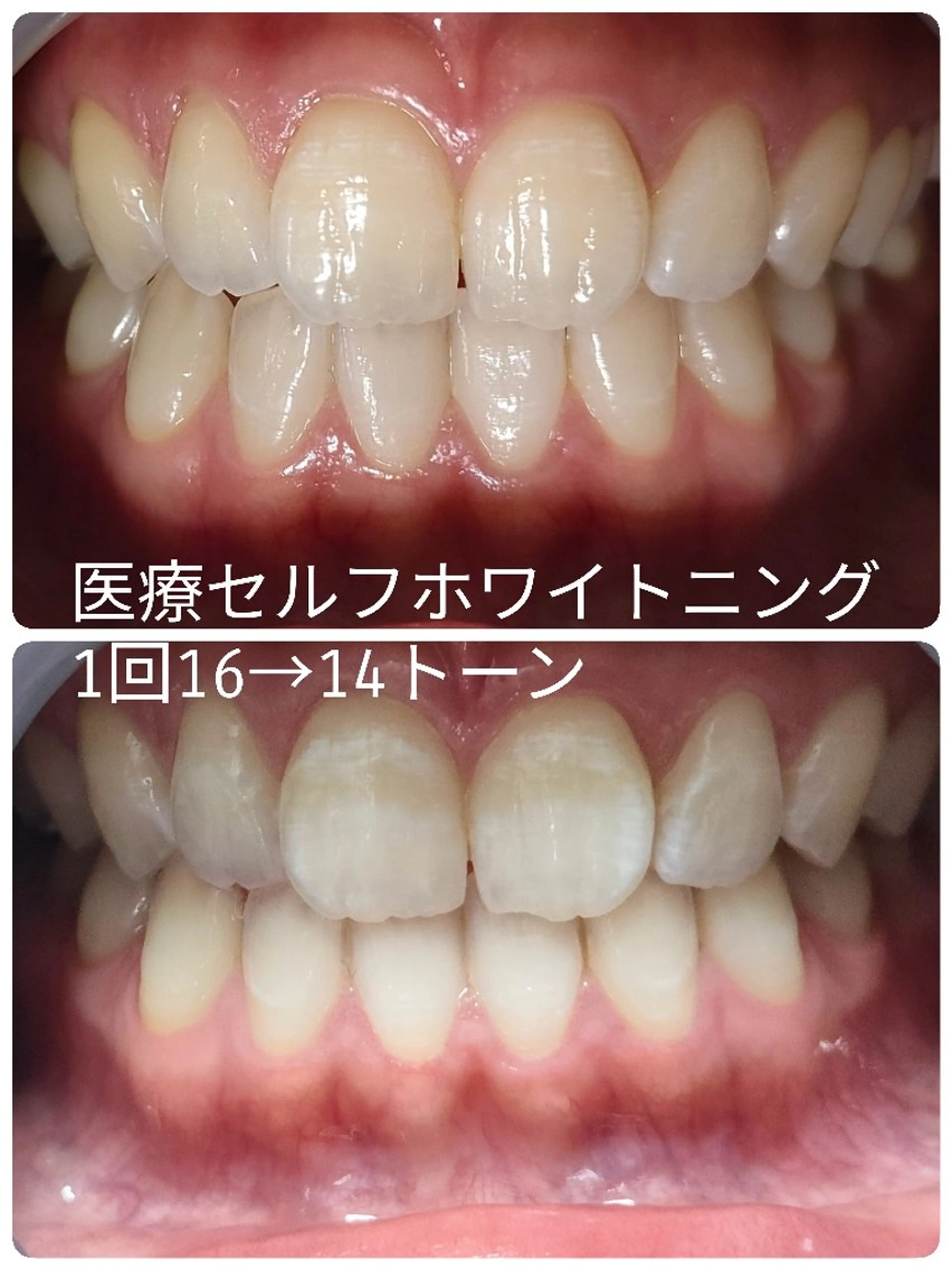 ほわいと あざぶのマツエク・マツパデザイン