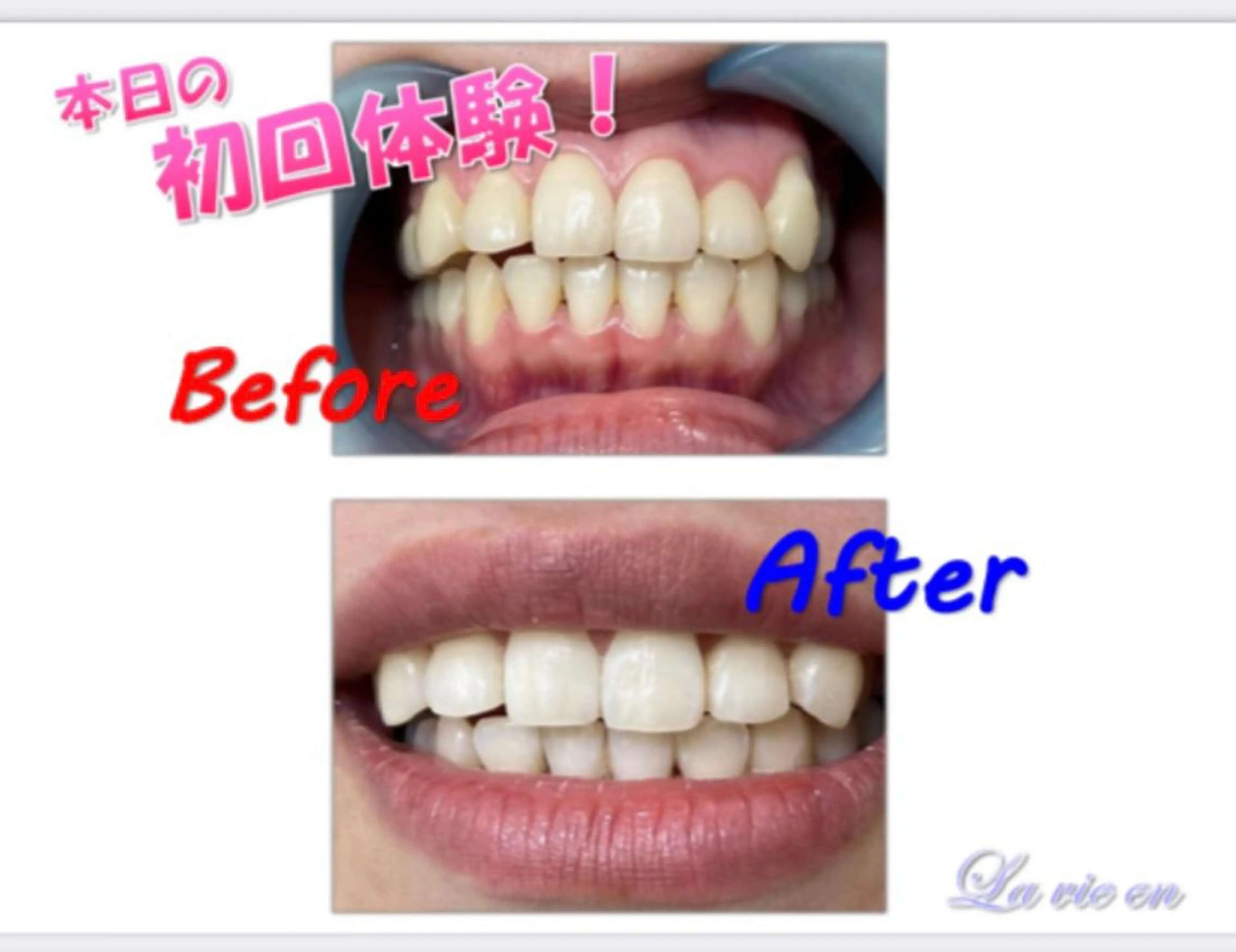 その他 セルフホワイトニングサロン　ラヴィアン所属・ホワイトニングサロン La vie enのその他イメージ