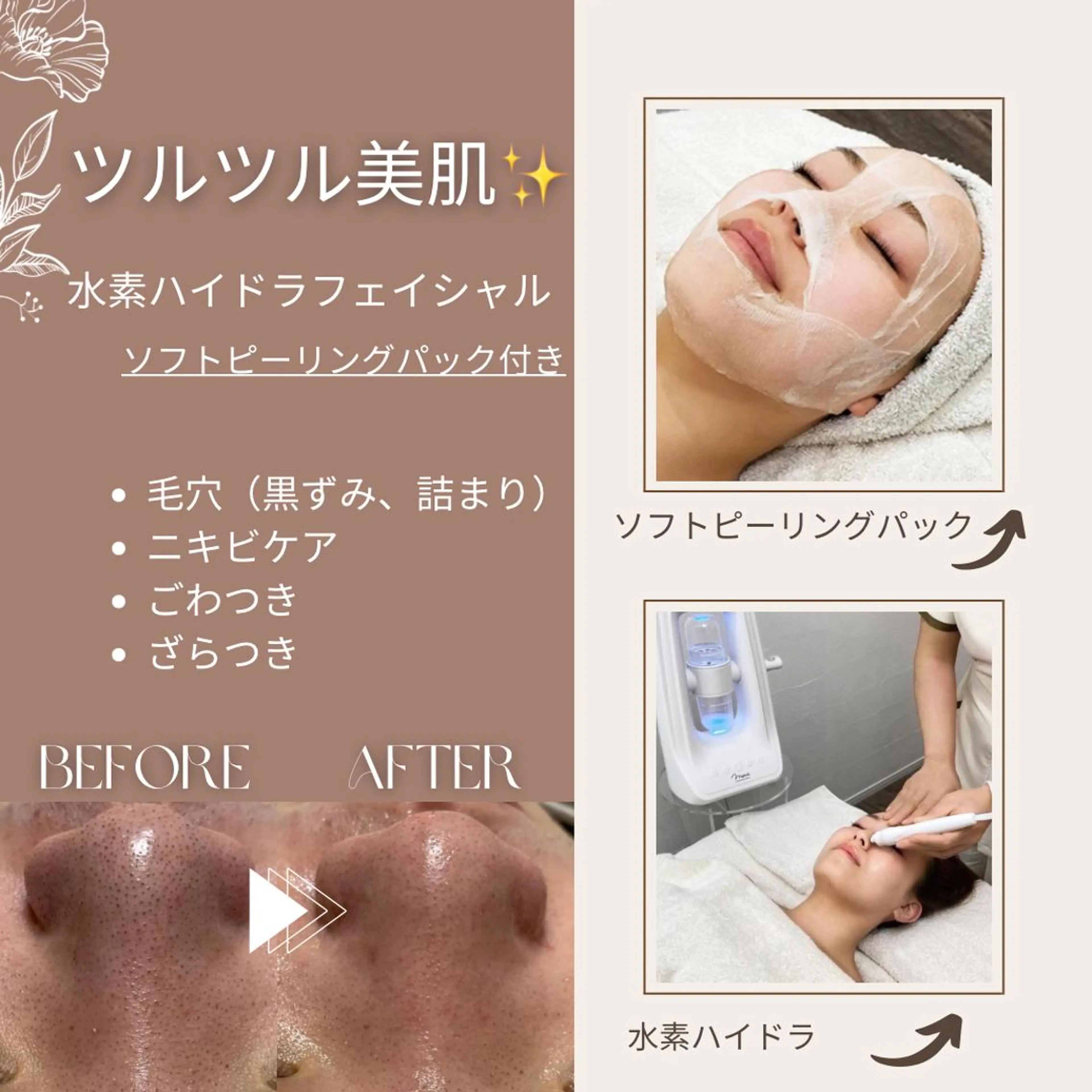 【🉐minimo特別価格📣】ごっそり毛穴汚れ🍓✨ハイドラフェイシャル✨ピーリング付き❗️毛穴ケア/ざらつき/くすみの写真