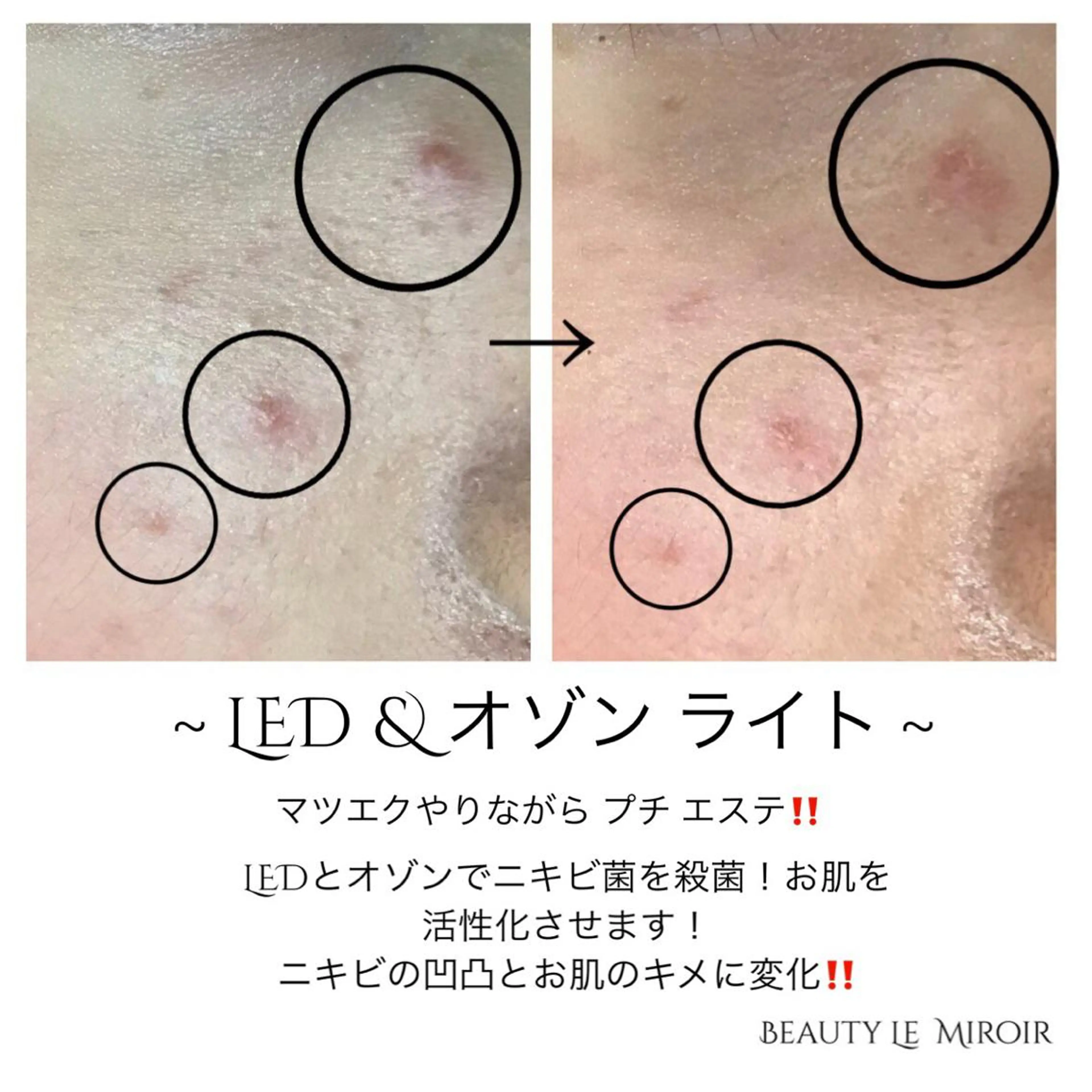 ビューティー ミロワールのエステ・リラクイメージ