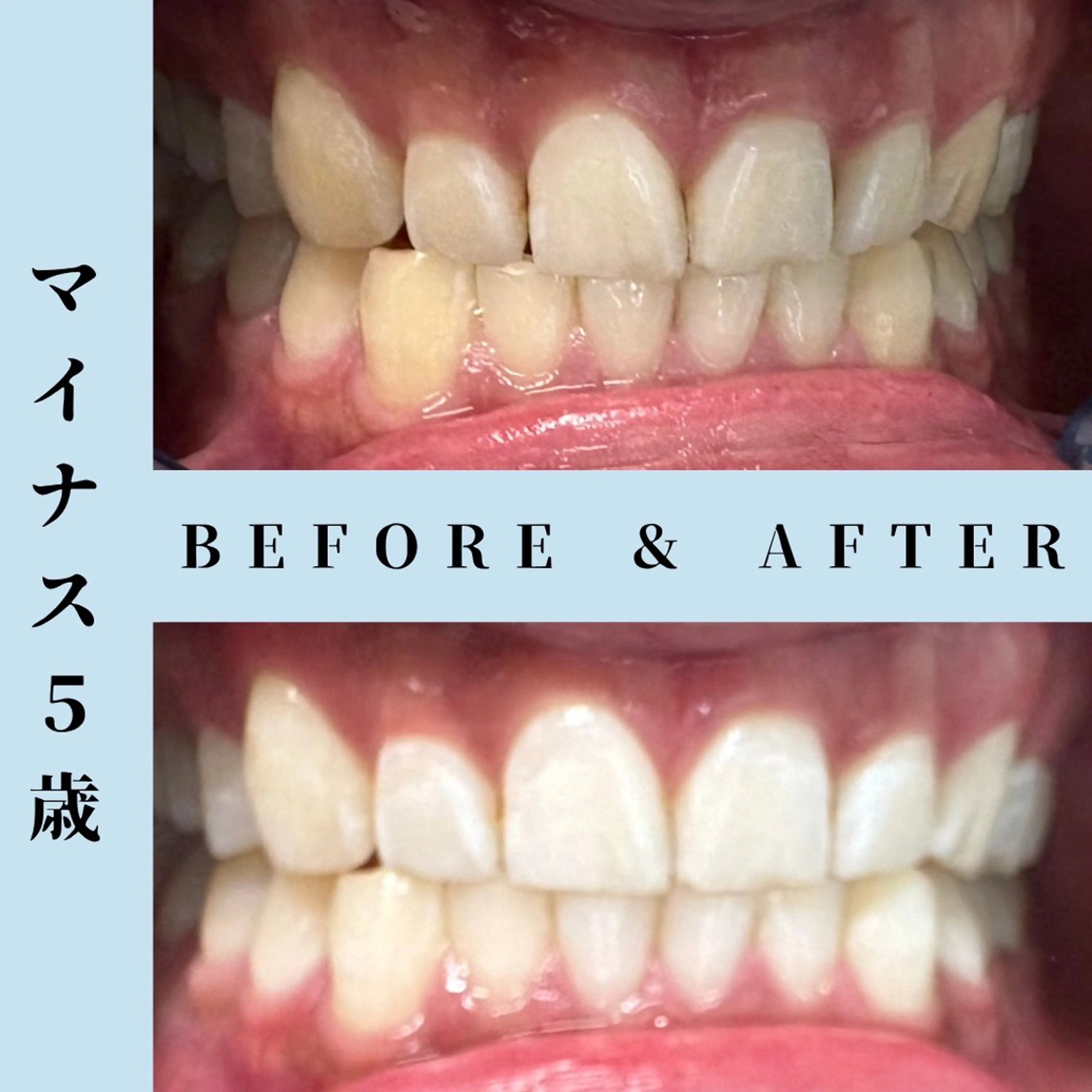 その他 セルフホワイトニング Dolce水戸店のその他イメージ