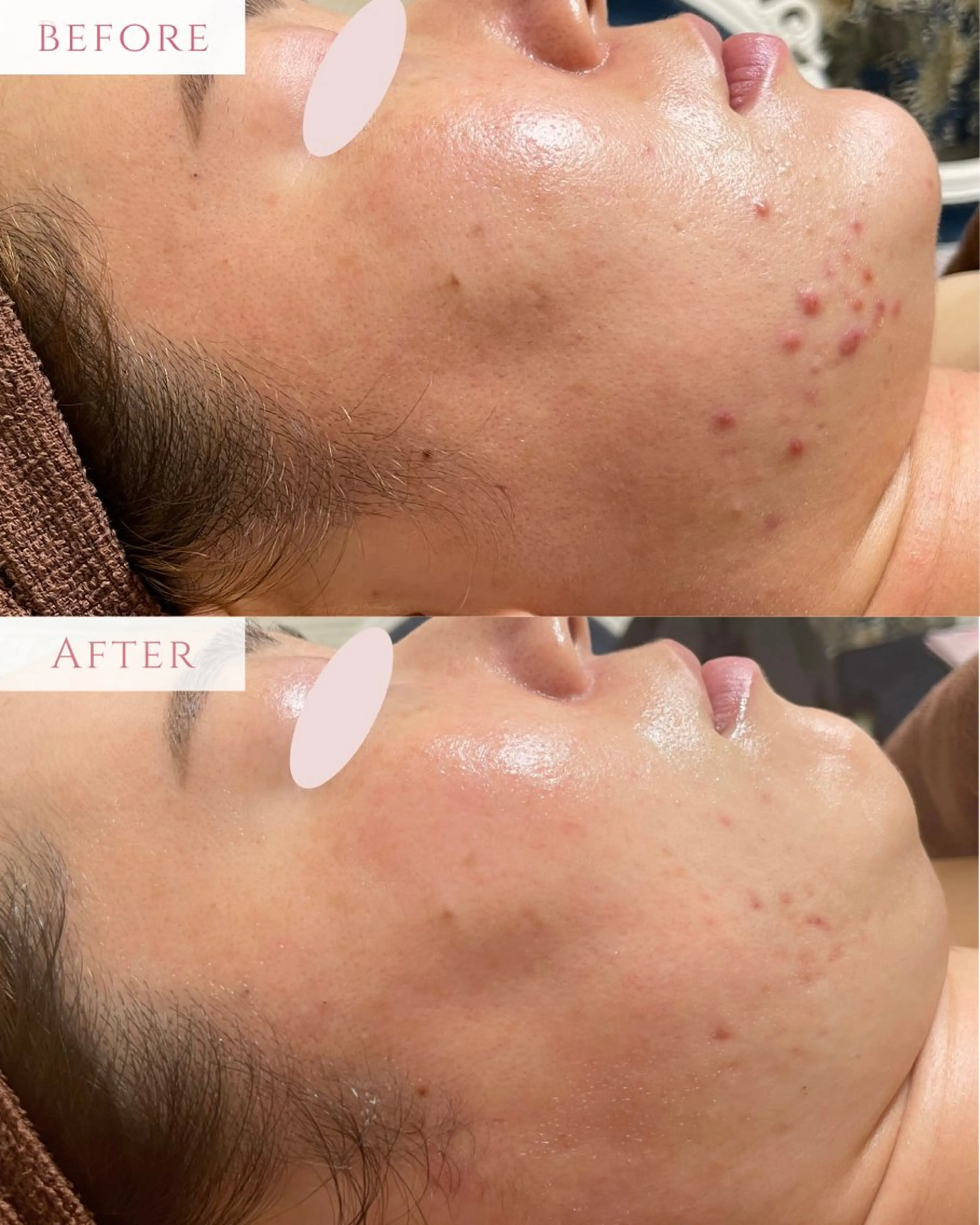 エステ 肌質改善サロン LesFleursのエステ・リラクイメージ