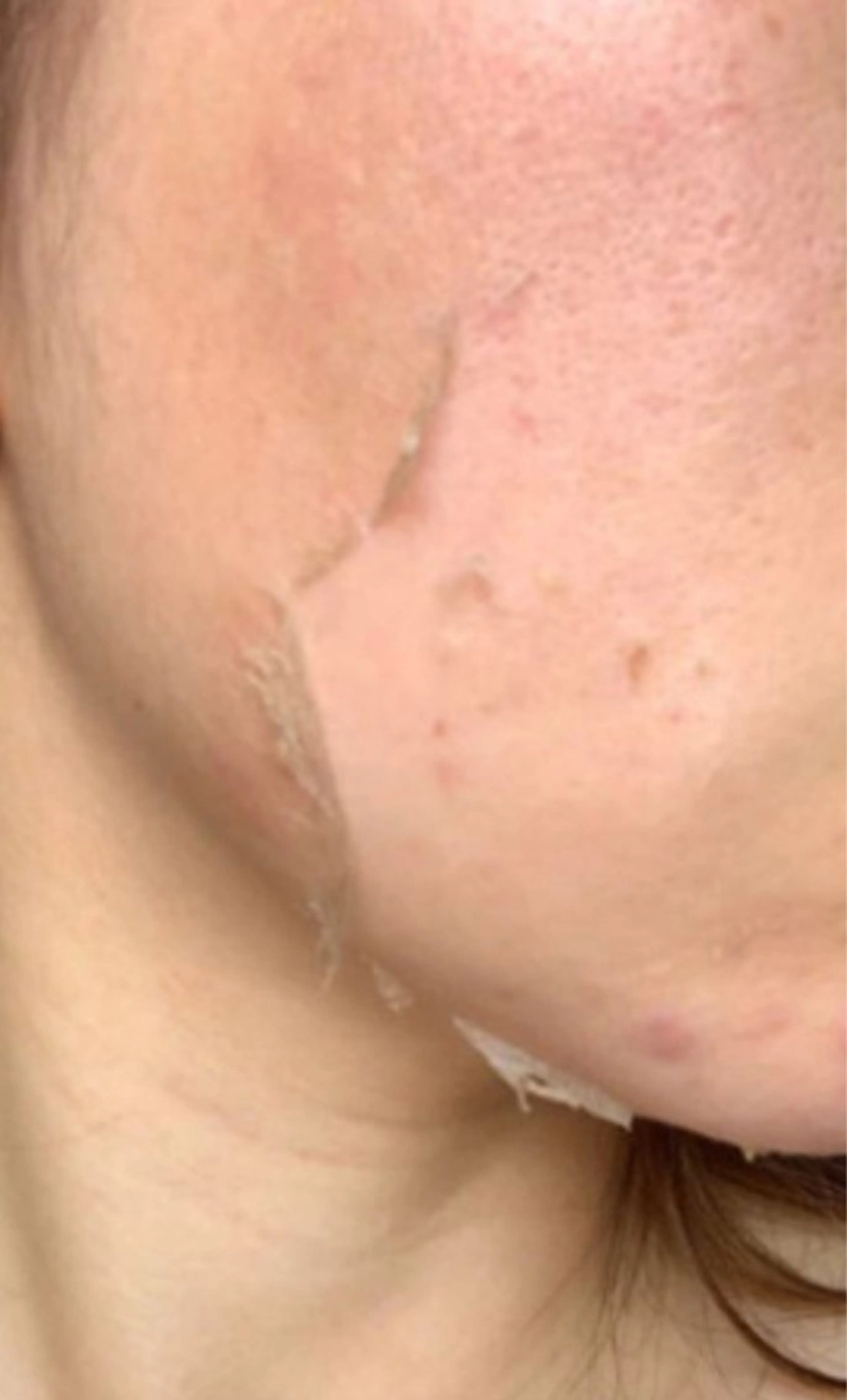 オールハンド フェイシャルのエステ・リラクイメージ