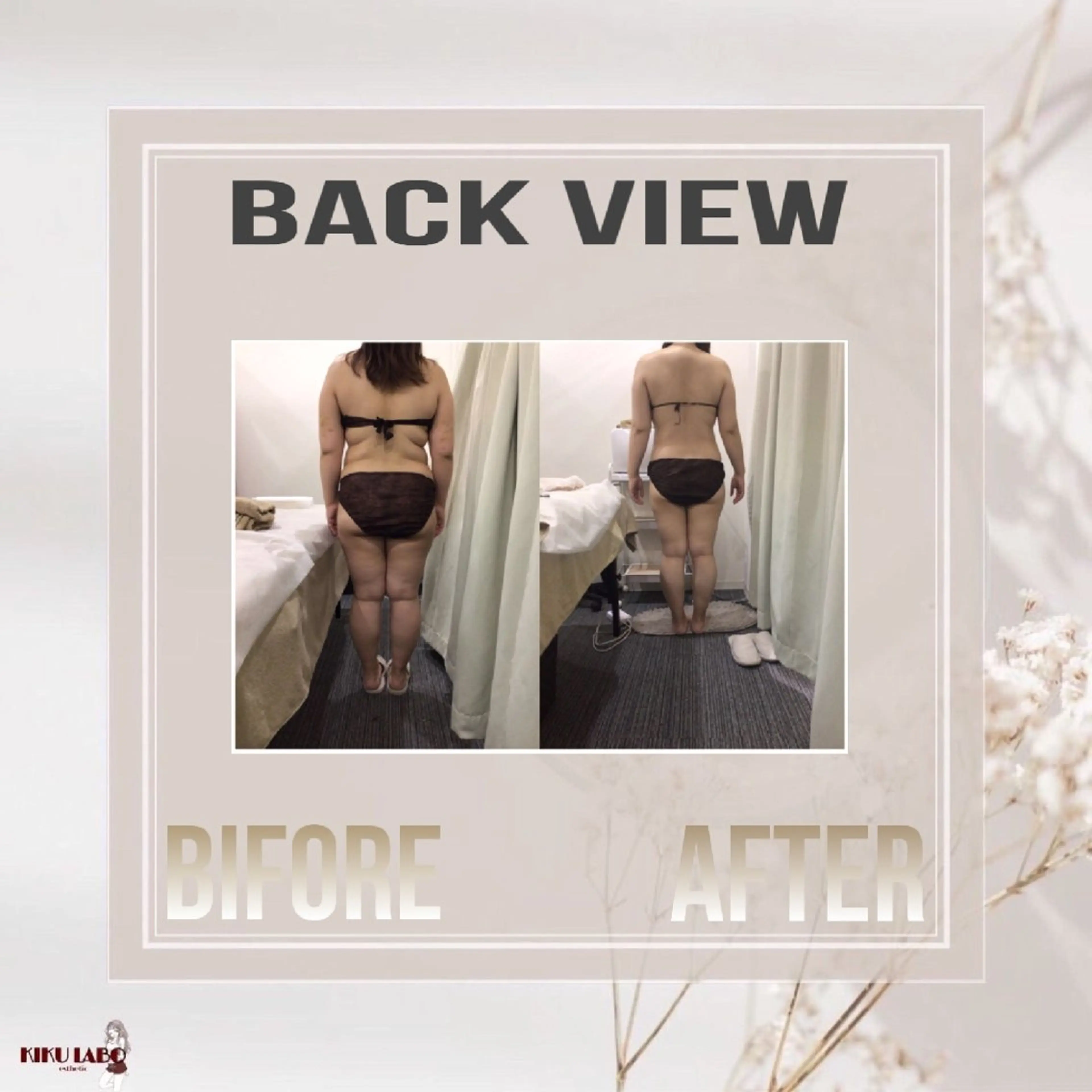 【2〜4回目までのミニモ限定価格✨️】お腹・背中痩せ集中コース◎通常価格16000円→8990円の写真