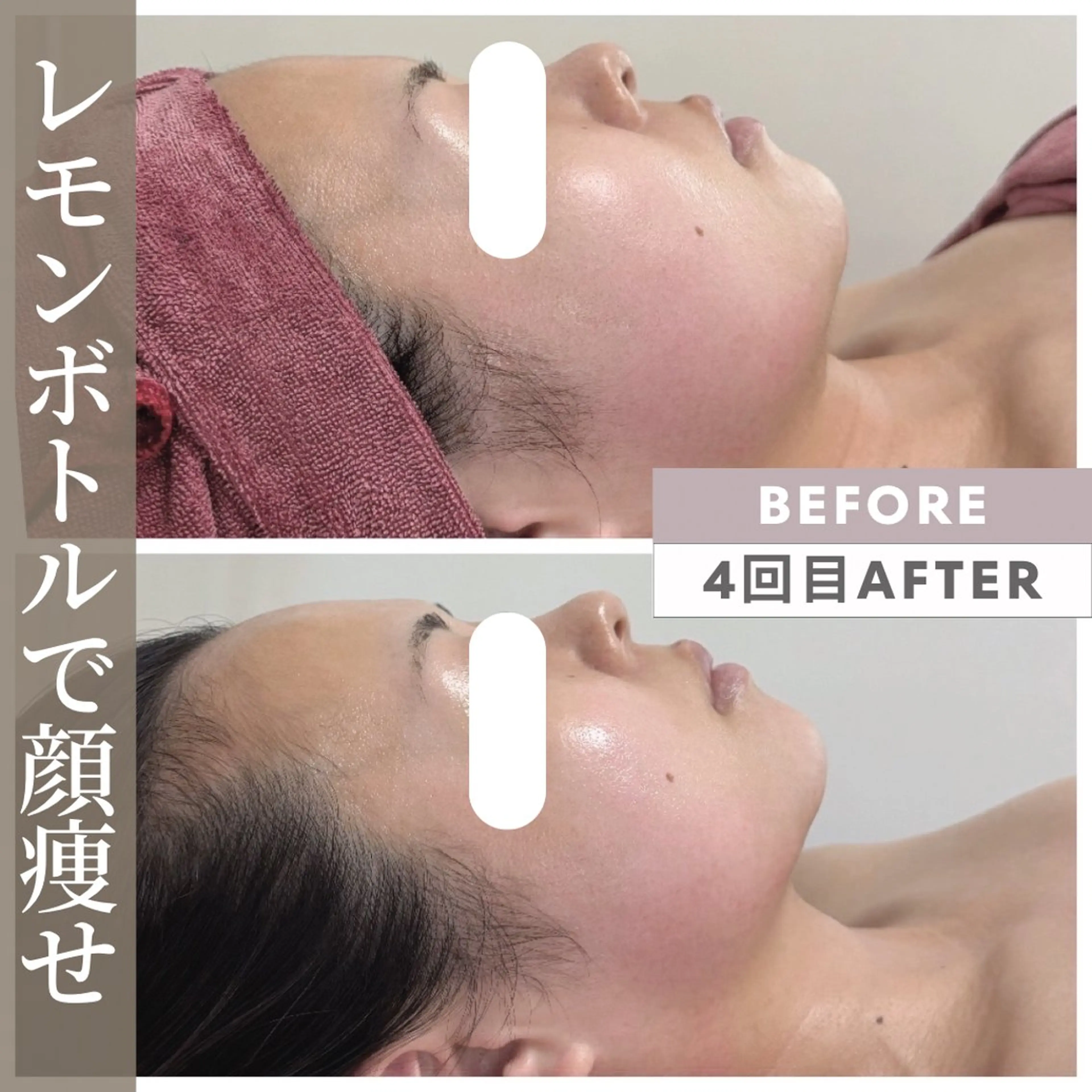 エステ リラク 小顔矯正専門店 【RED】池田のエステ・リラクイメージ