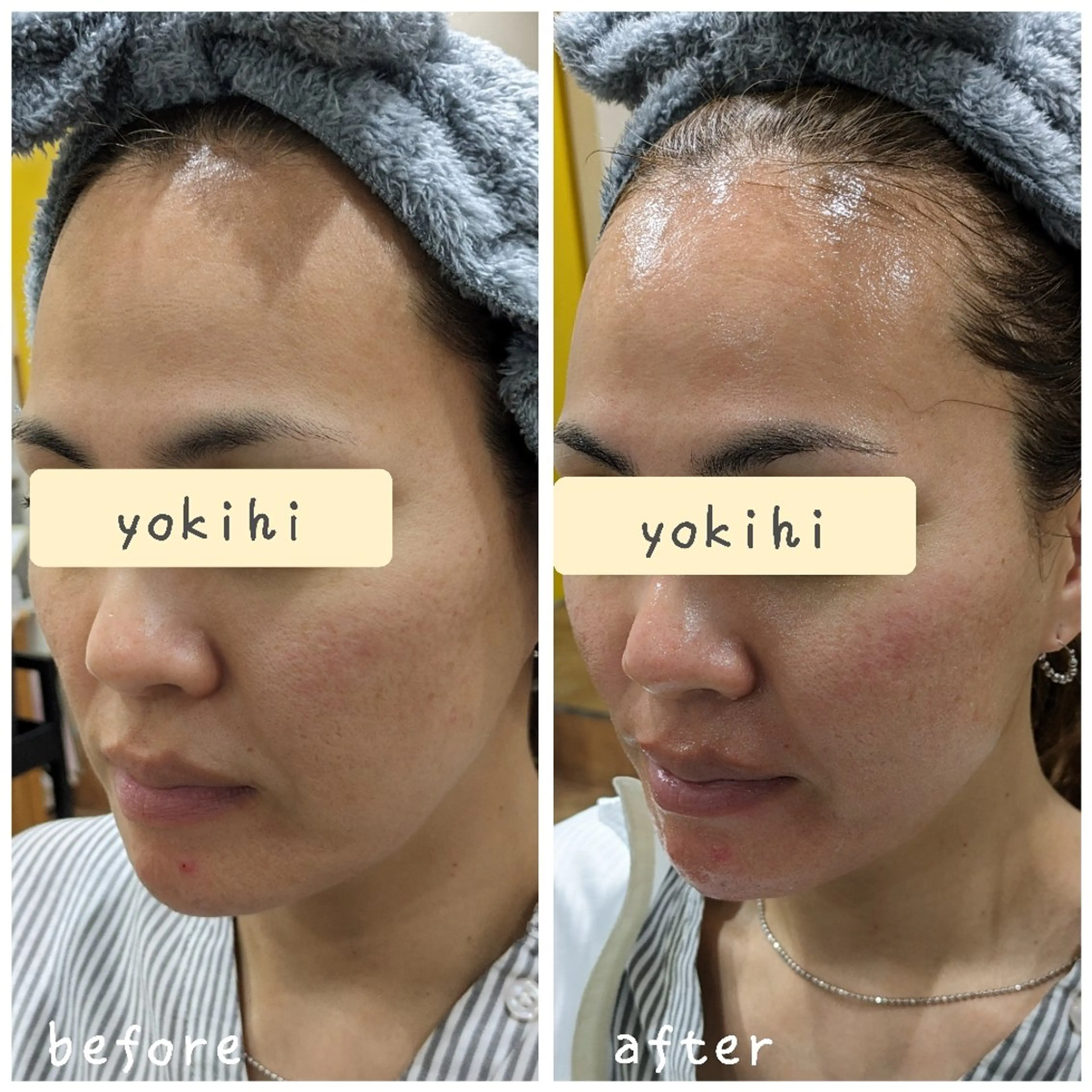 自然由来スキンケア/ 肌質改善/まつパのエステ・リラクイメージ