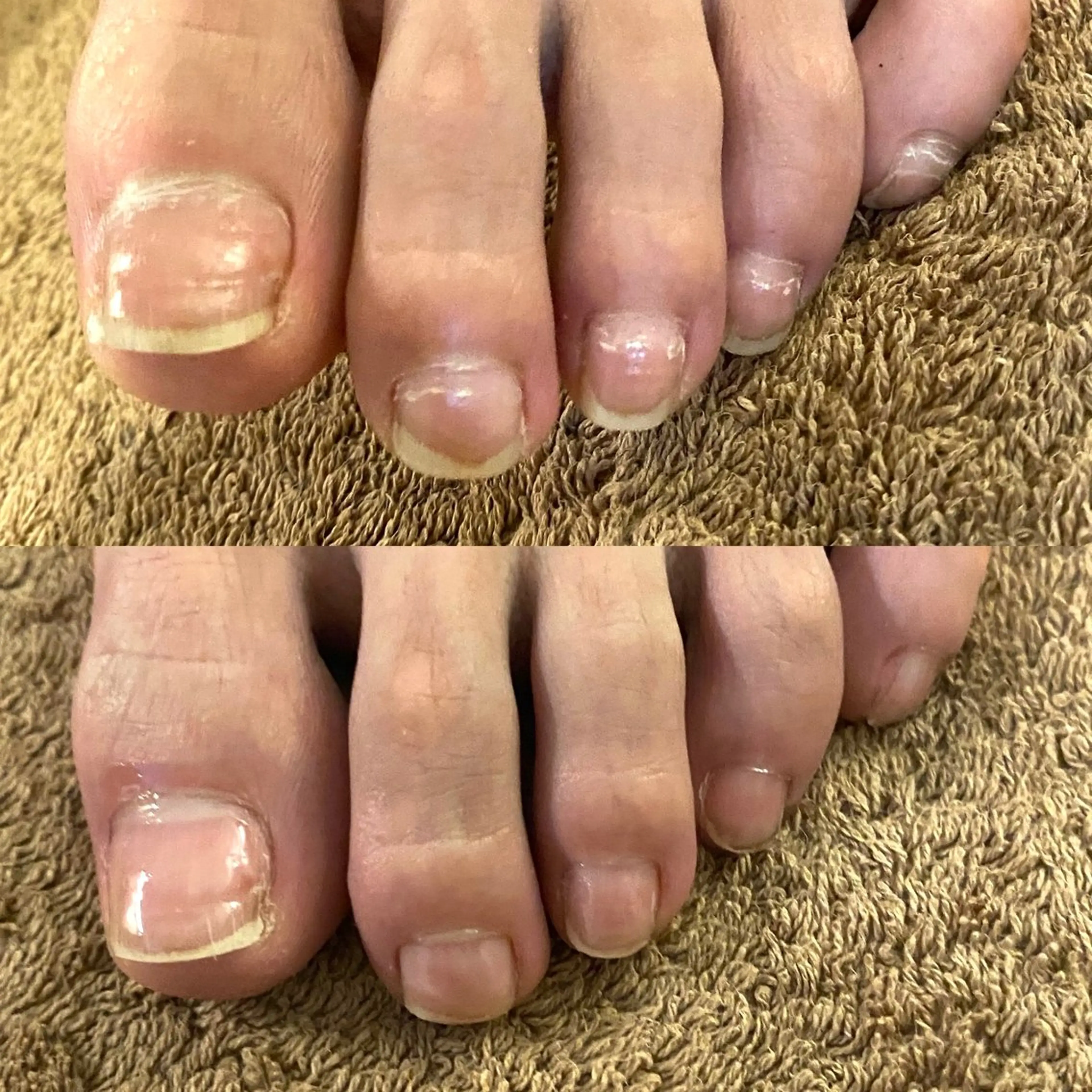 痛い巻き爪も解消！爪周りケア付きメンズ専門店の写真