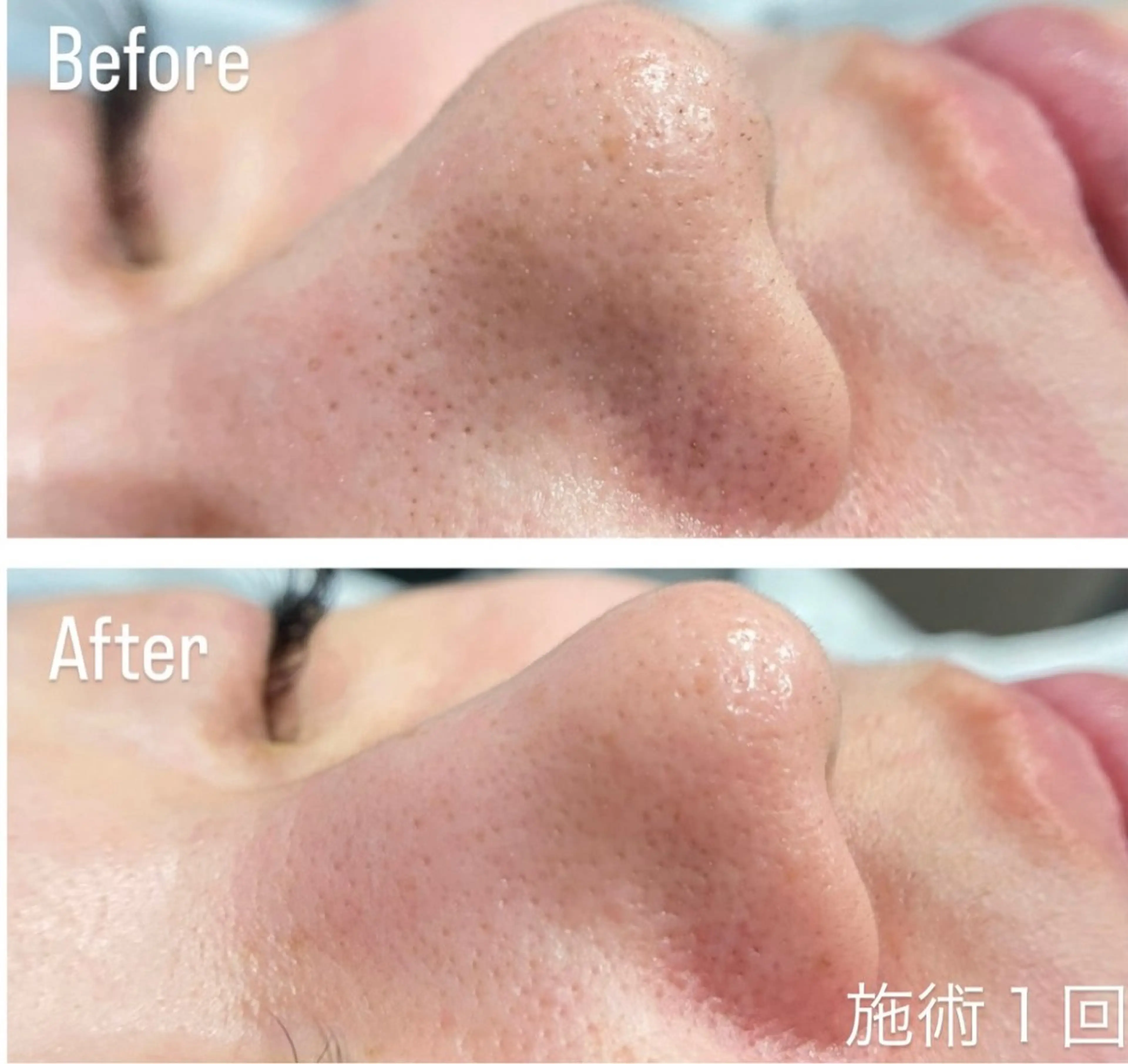 アンド ミルルのエステ・リラクイメージ