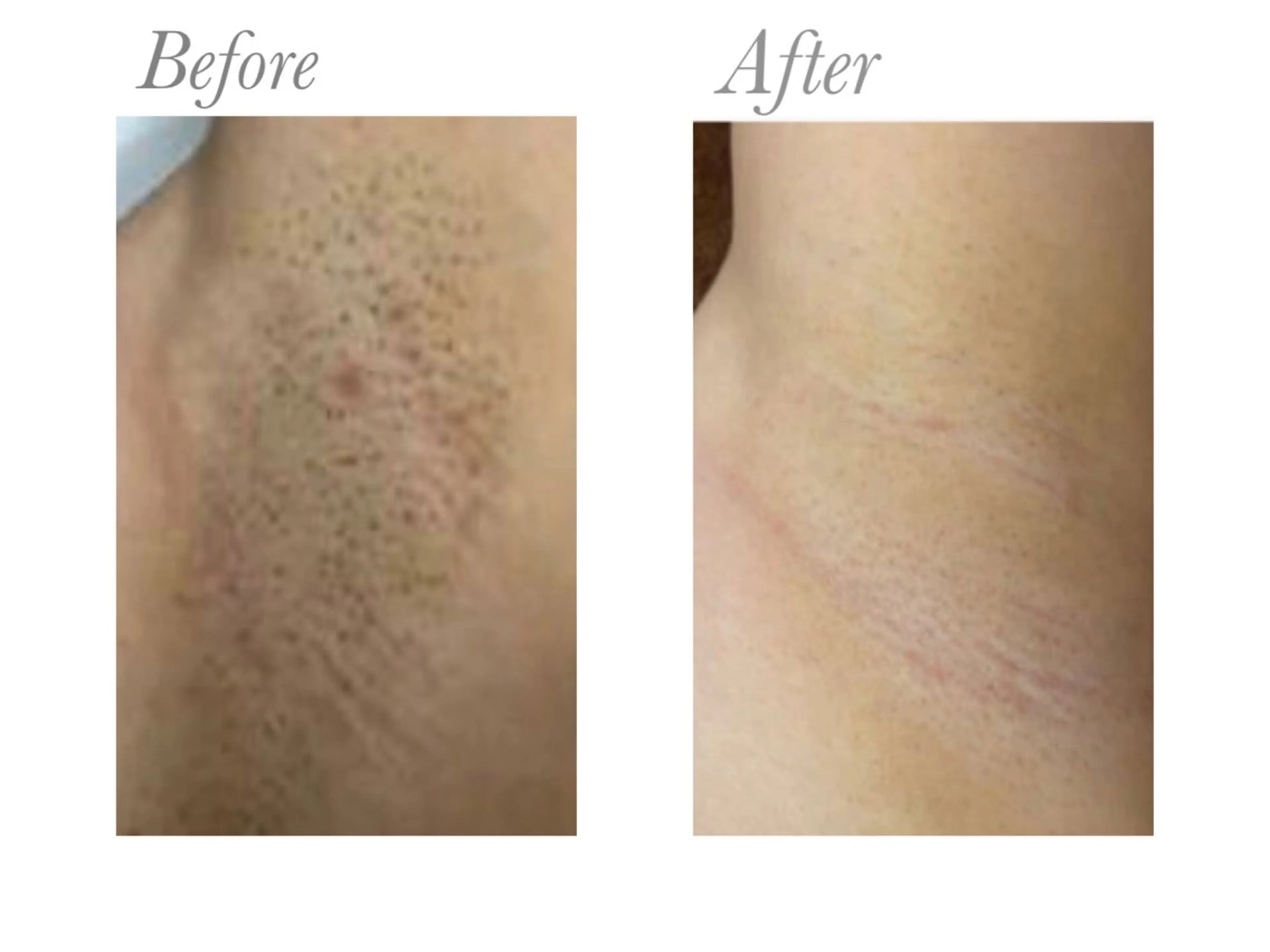 NAYU/レディース 眉毛/堺筋本町の眉毛・アイブロウイメージ