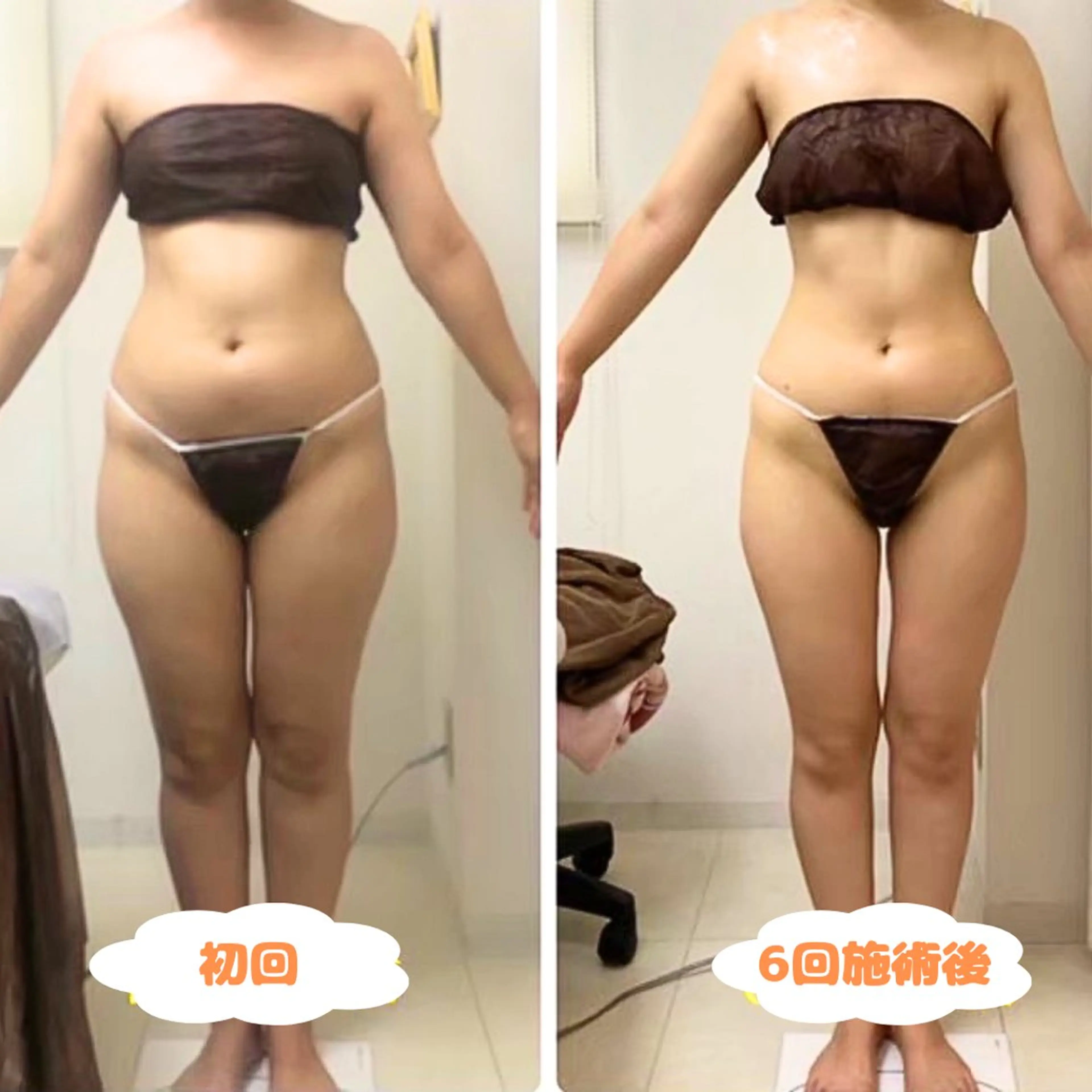 【本気🔥&全部痩せ希望の方⚠️】痩身全身×2回✨骨格矯正も🙆🏻‍♀️代謝の上がる冬はダイエットのチャンス！！の写真