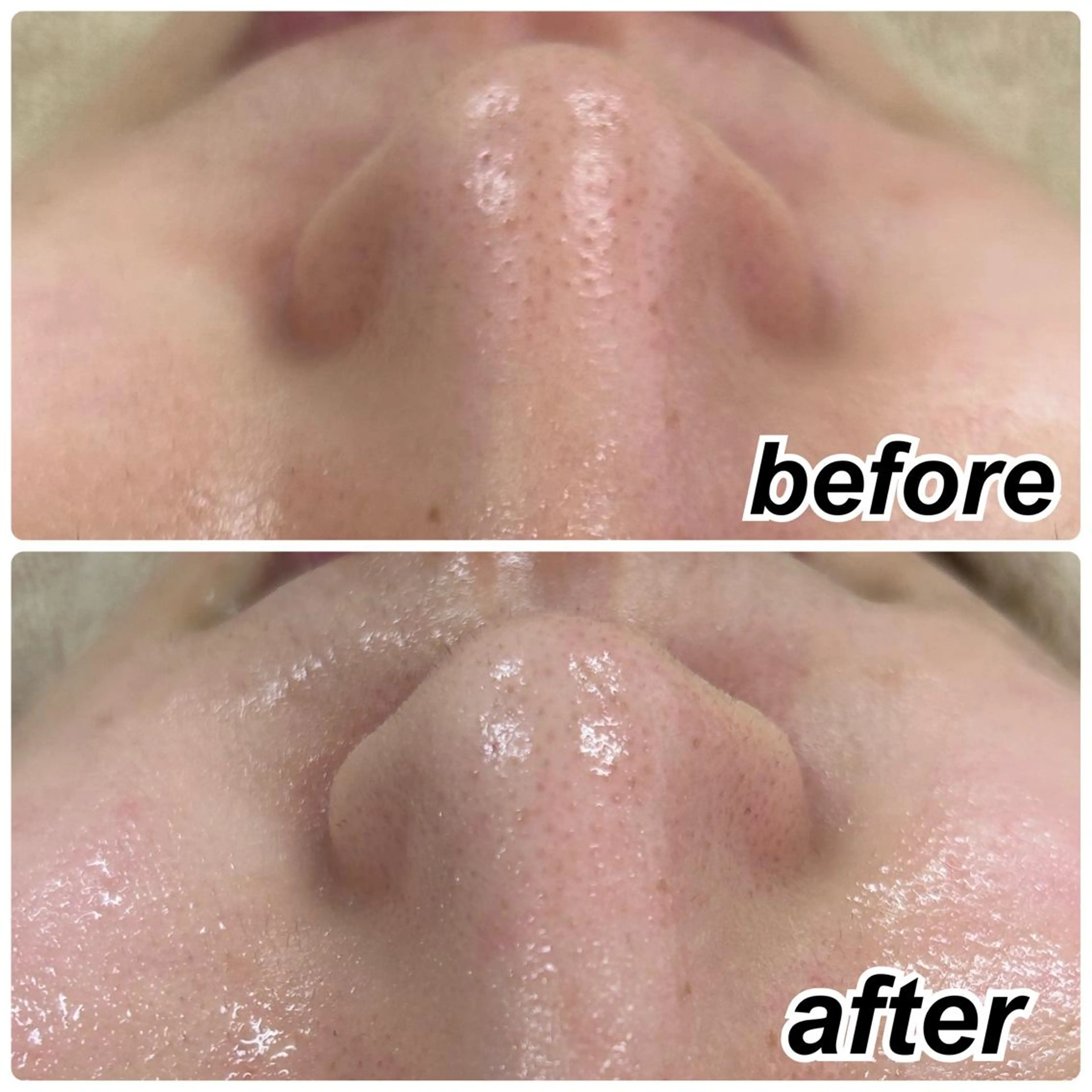 エステ Venus所属・エステサロン Venusのその他イメージ