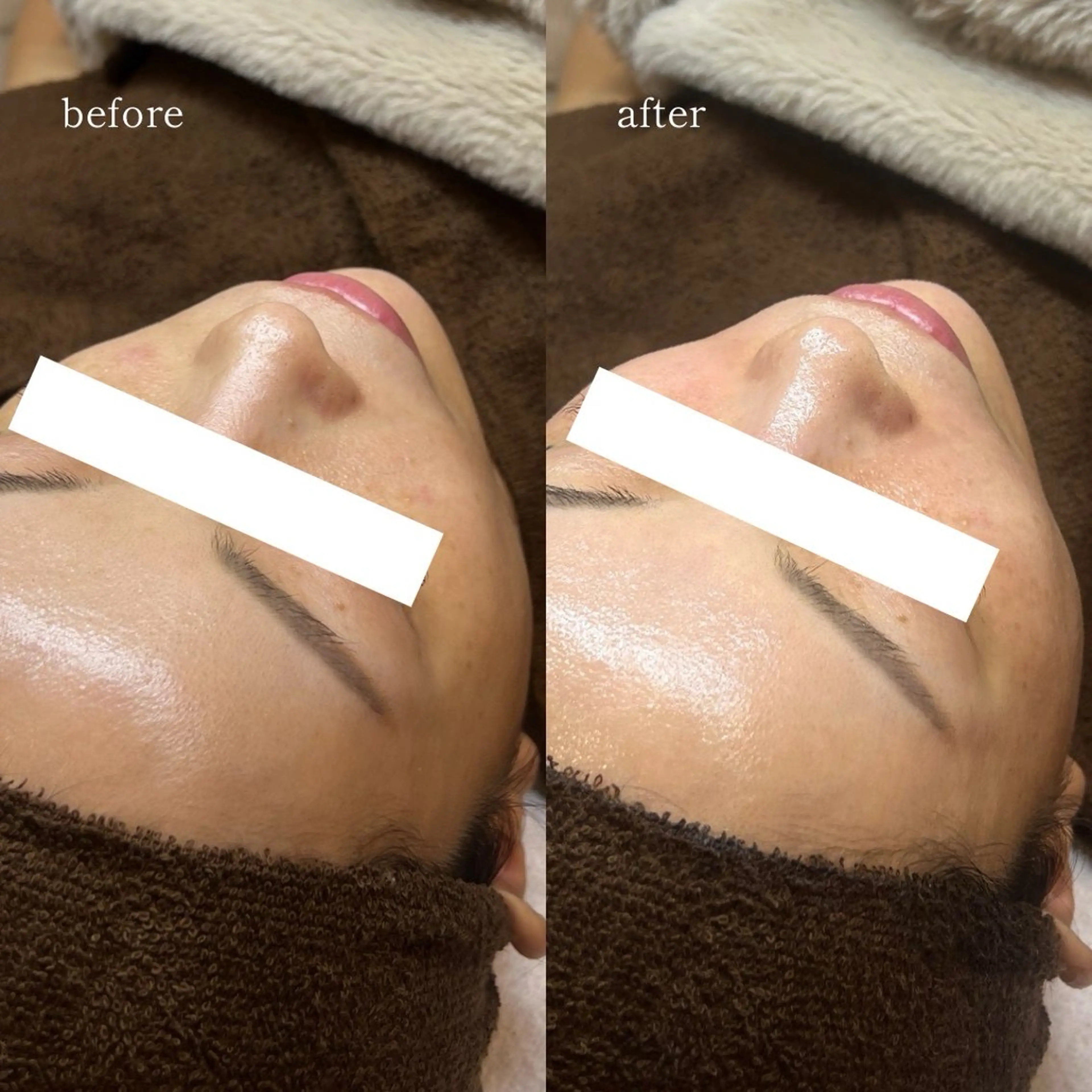 エステ 【韓国人肌製作所】 水光肌ならアーネストのエステ・リラクイメージ