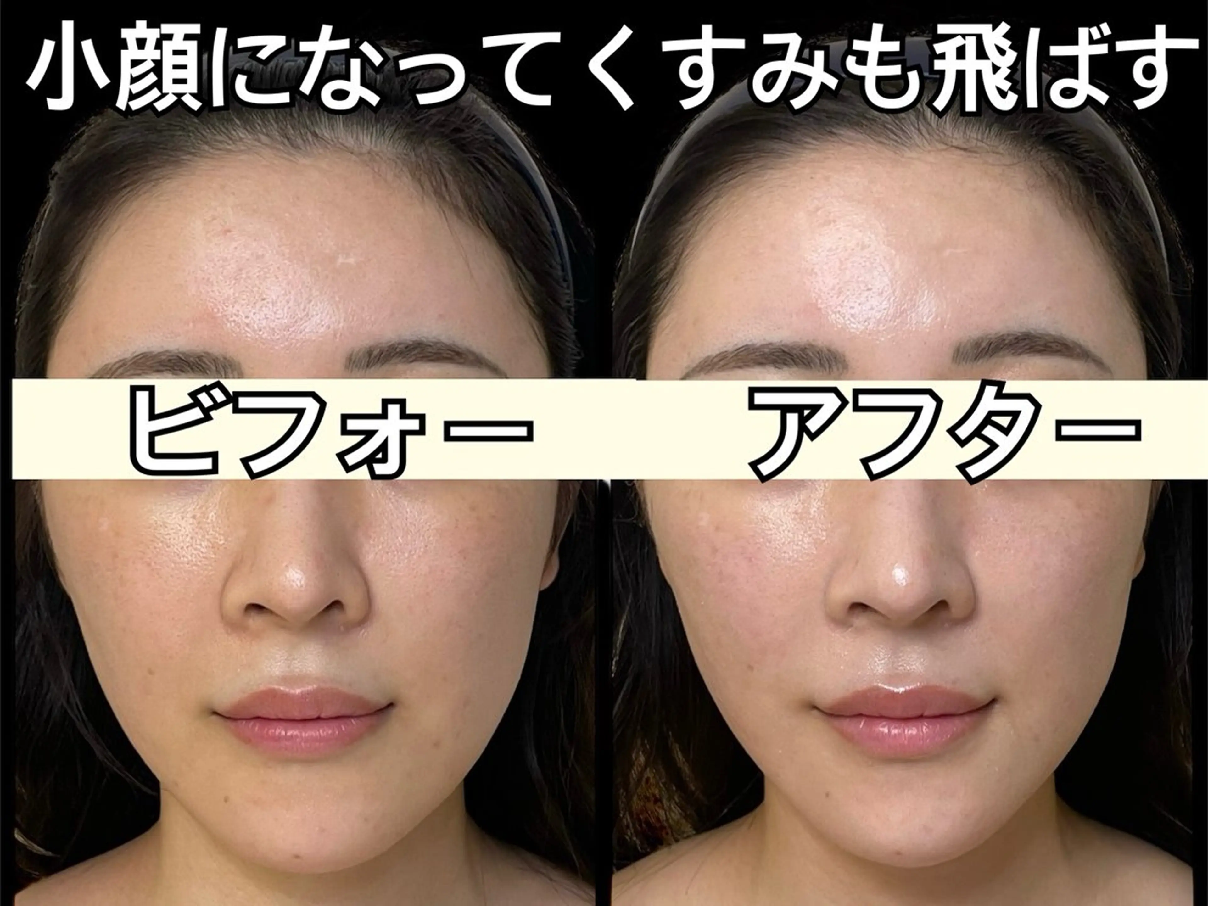 小顔専門看護師クリニカルサロンCOCO所属・小顔と美肌サロン クリニカルサロンココのエステ・リラクイメージ