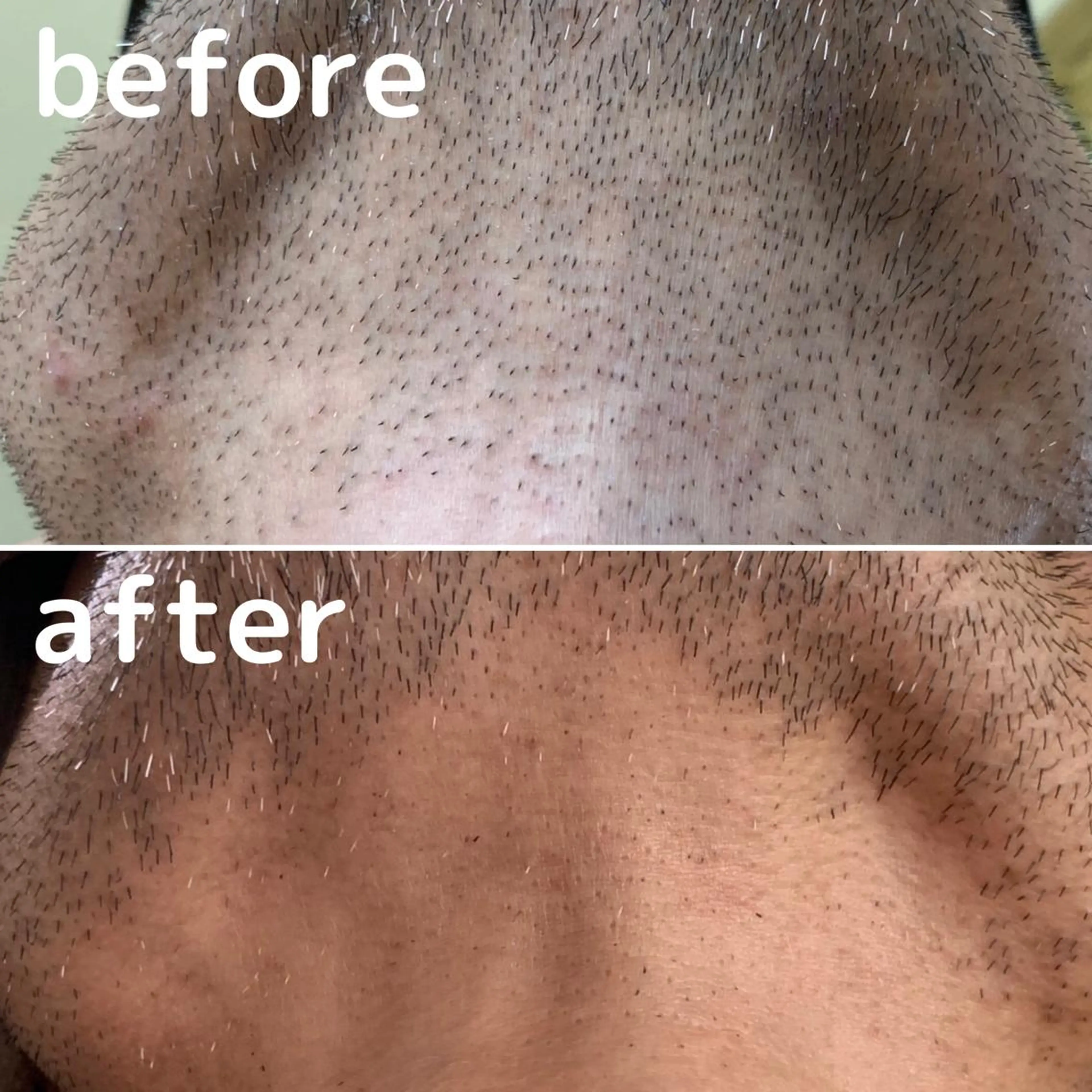 脱毛 美肌脱毛&光フェイシャルサロン　ギュネシ所属・脱毛&光フェイシャル サロン　ギュネシのエステ・リラクイメージ