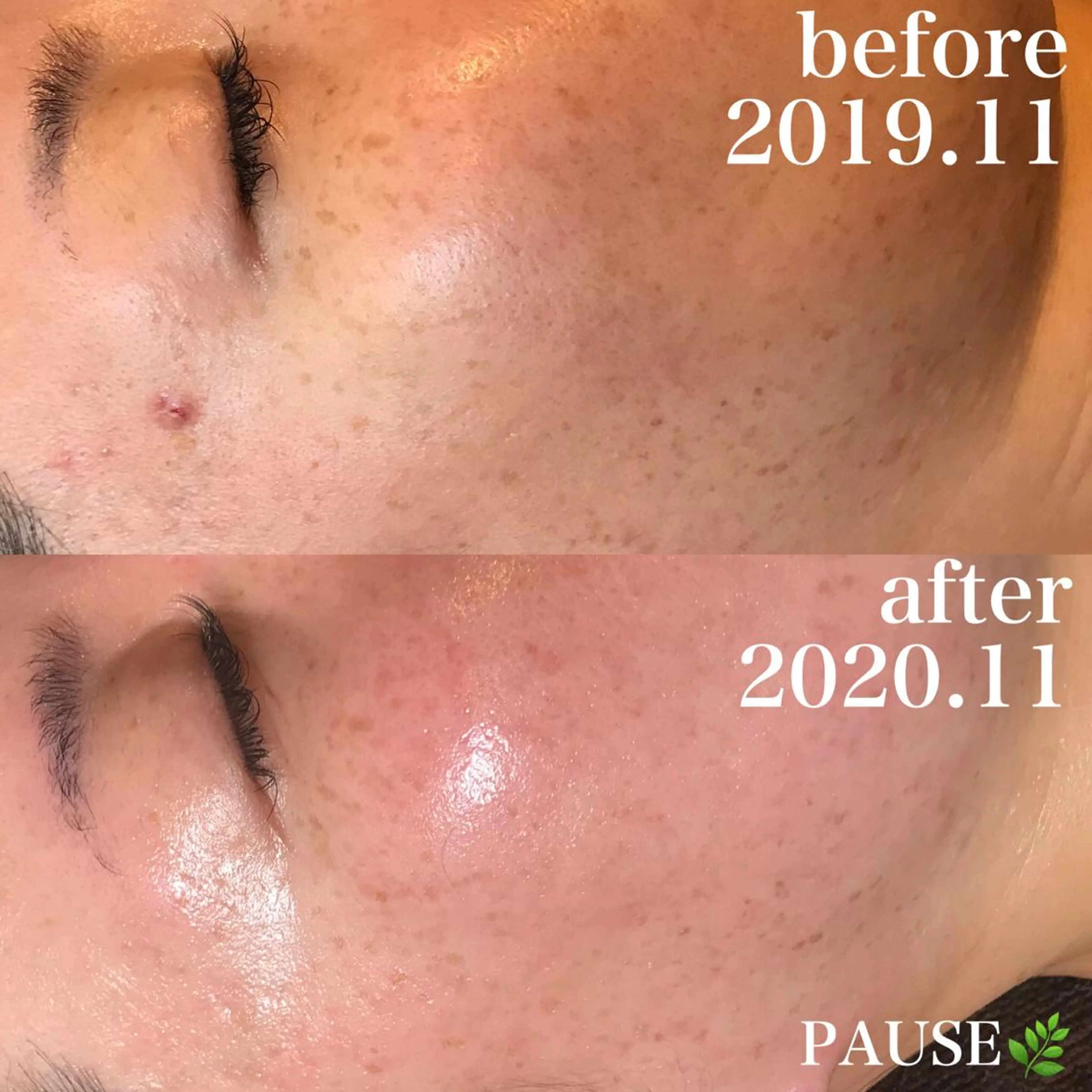 エステ 浜野 恵美のエステ・リラクイメージ