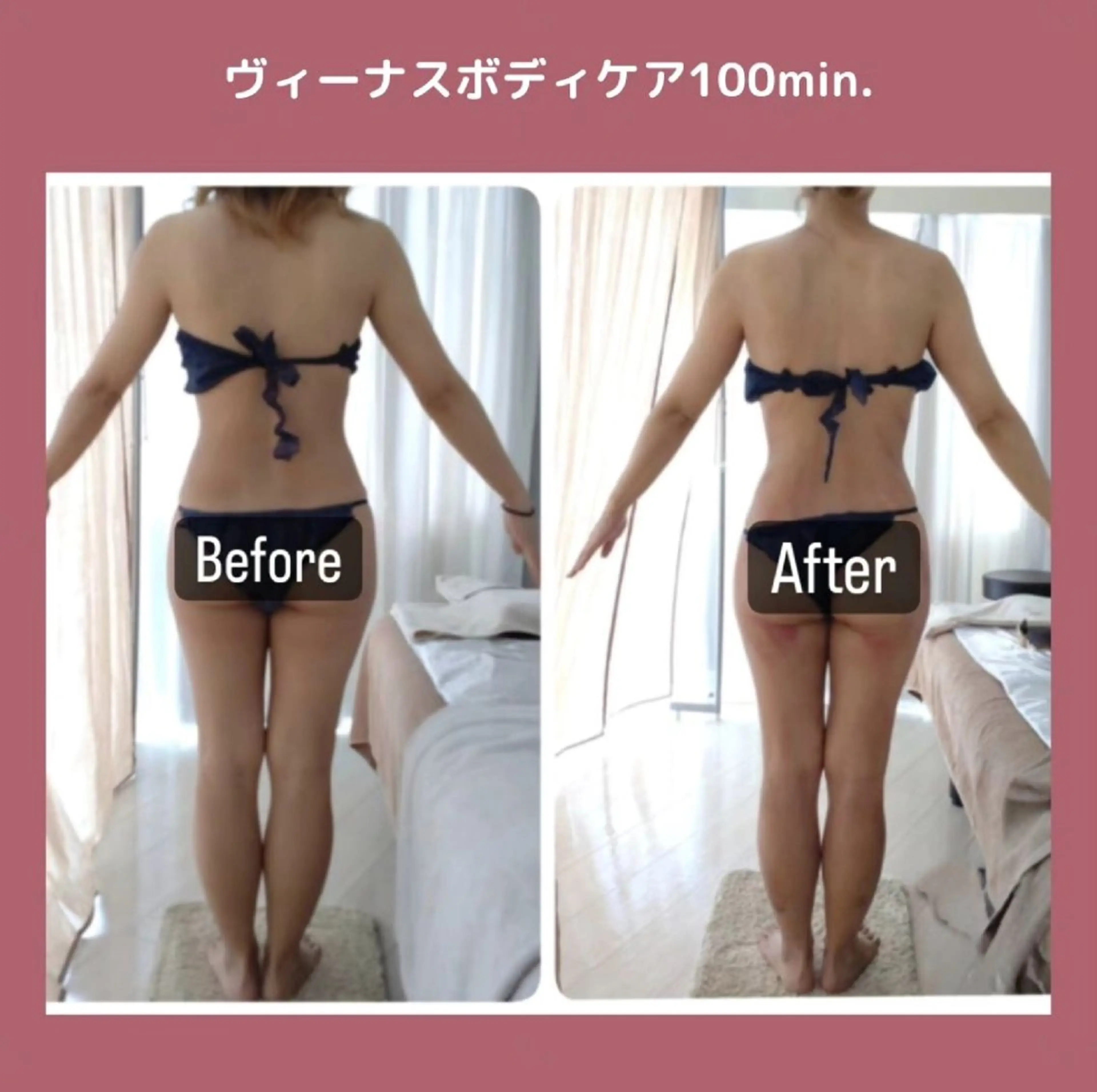 美肌/小顔専門店 peony.のエステ・リラクイメージ