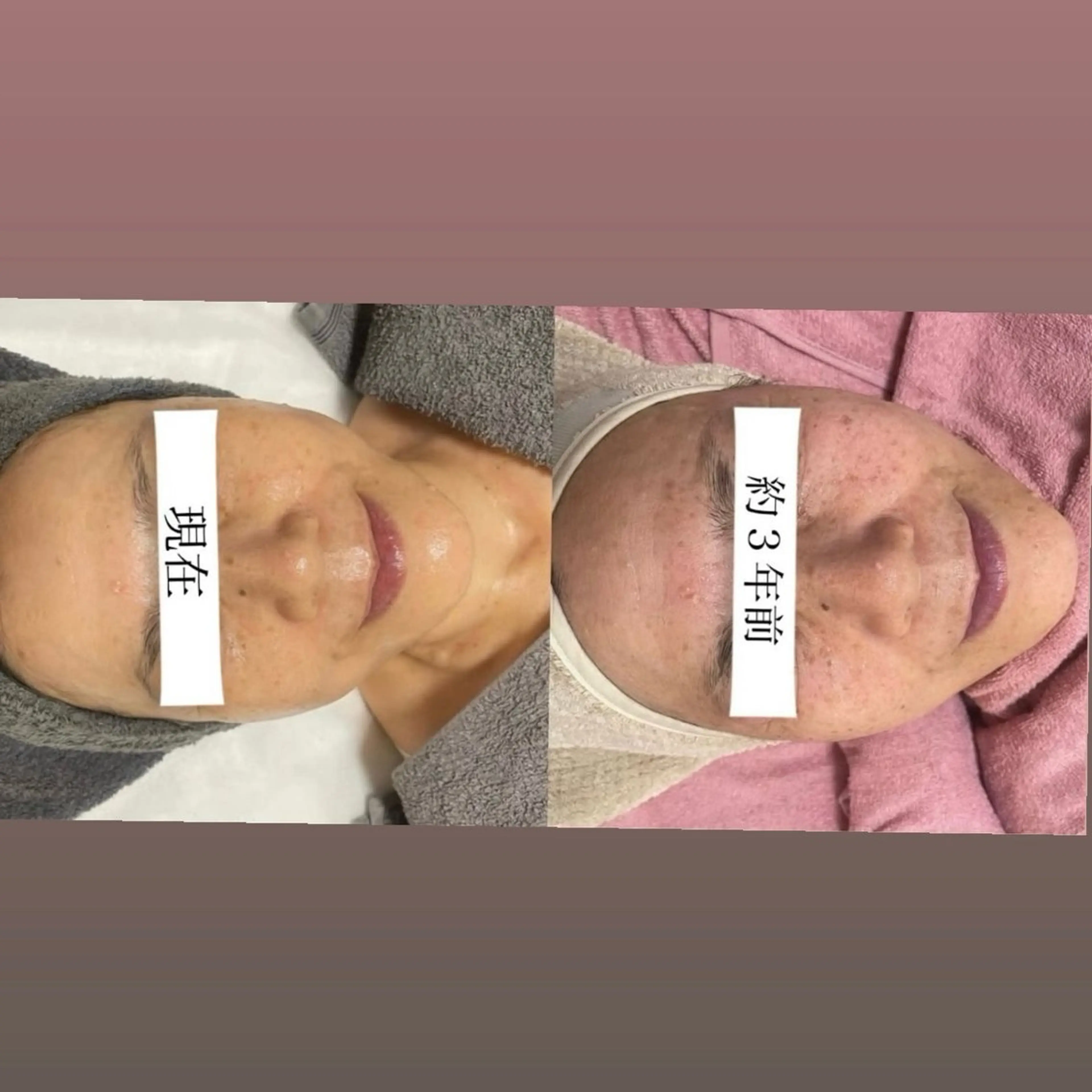 エステ 美肌専門サロン M 💎のエステ・リラクイメージ